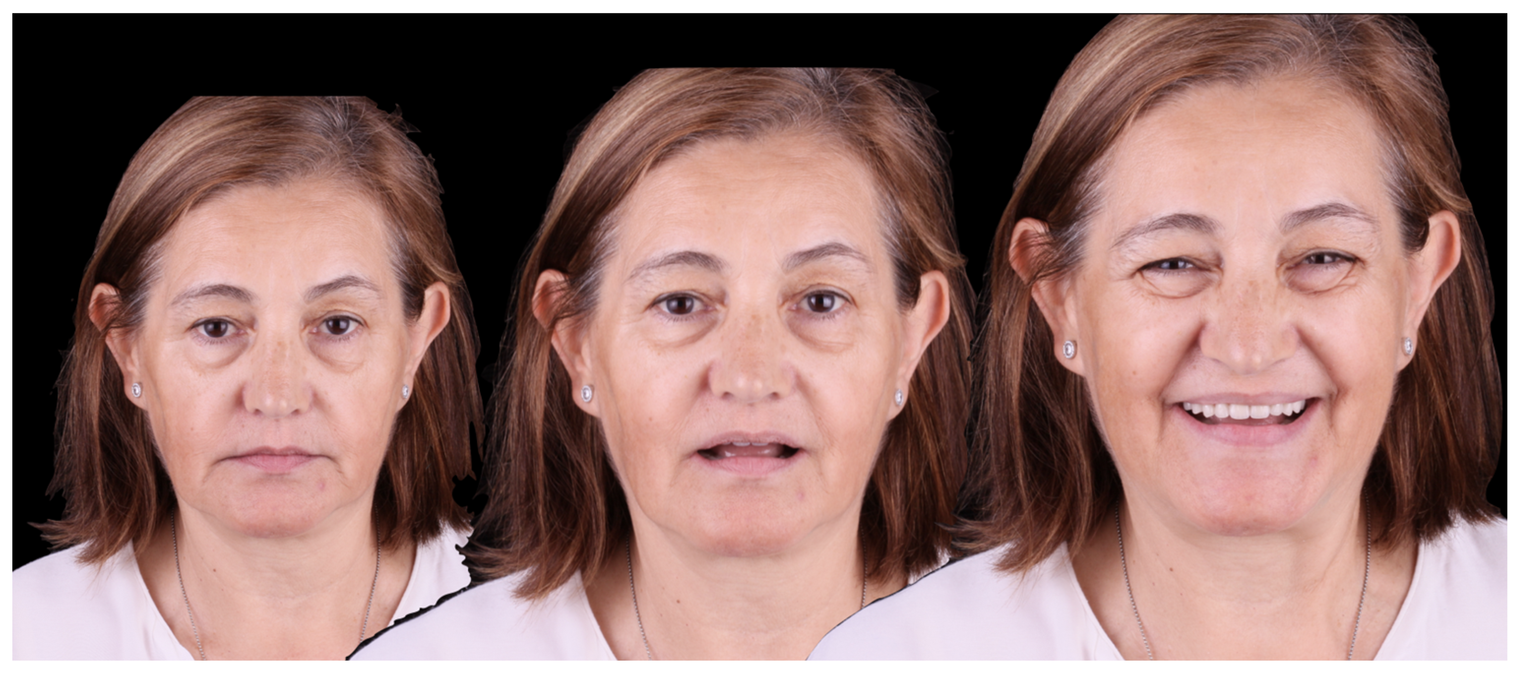 Jcm 12 07464 g016 Jcm 12 07464 g016