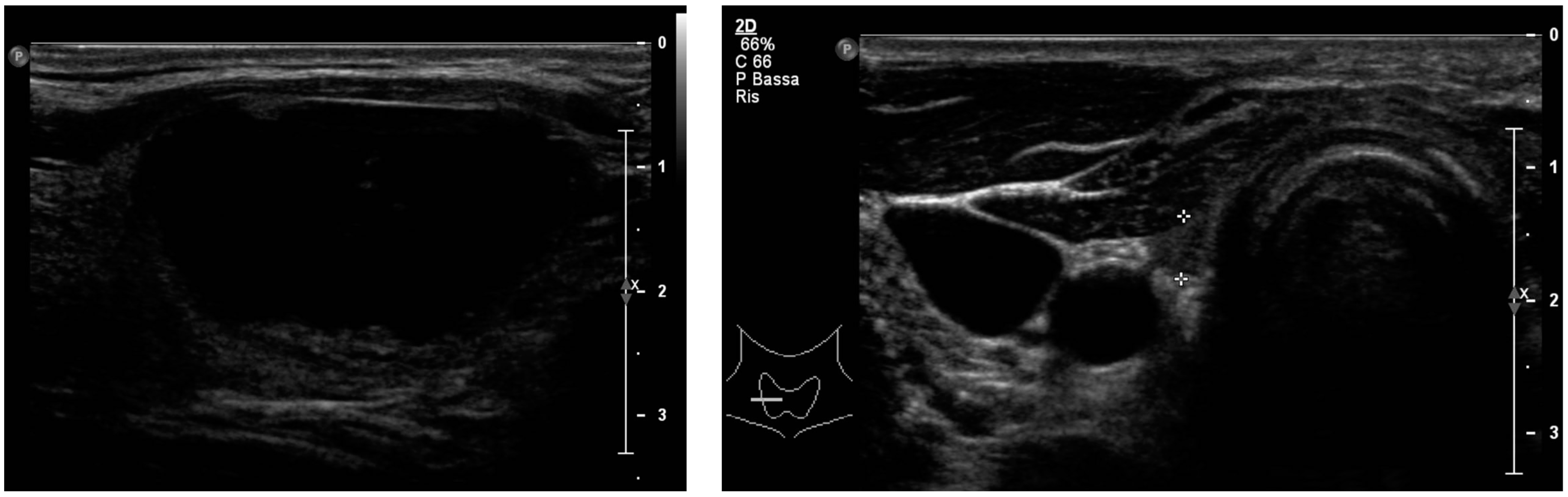 Jcm 12 07525 g003a Jcm 12 07525 g003a