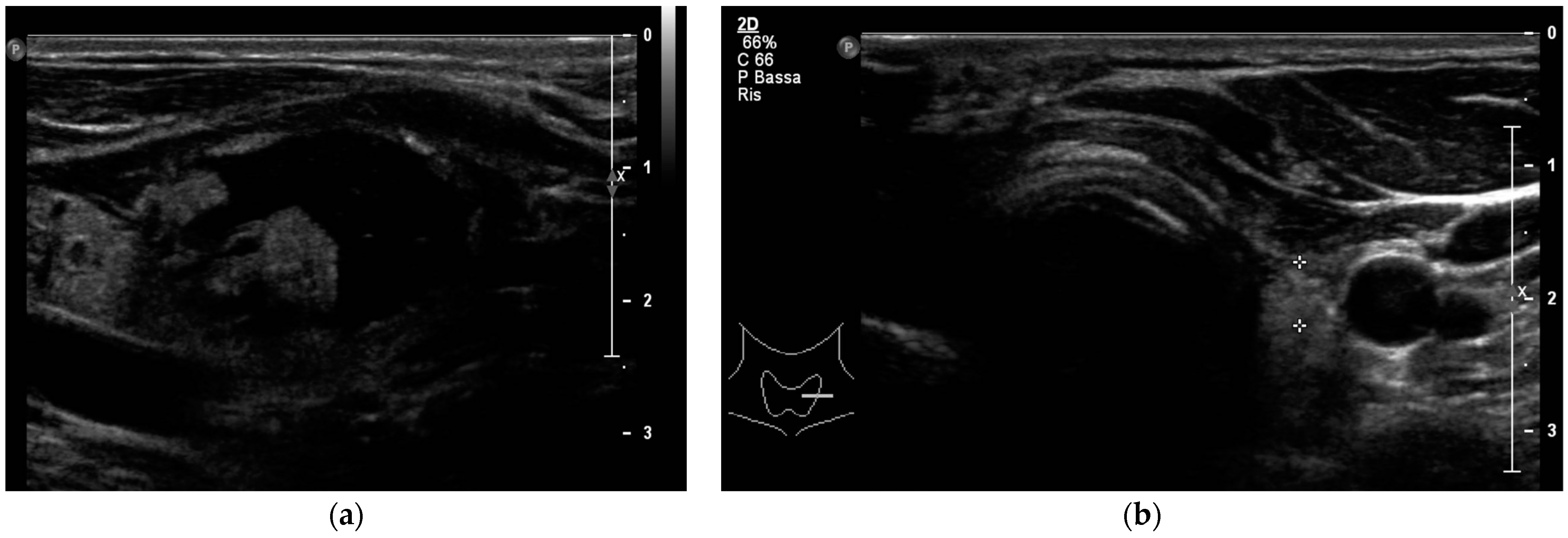 Jcm 12 07525 g003b Jcm 12 07525 g003b