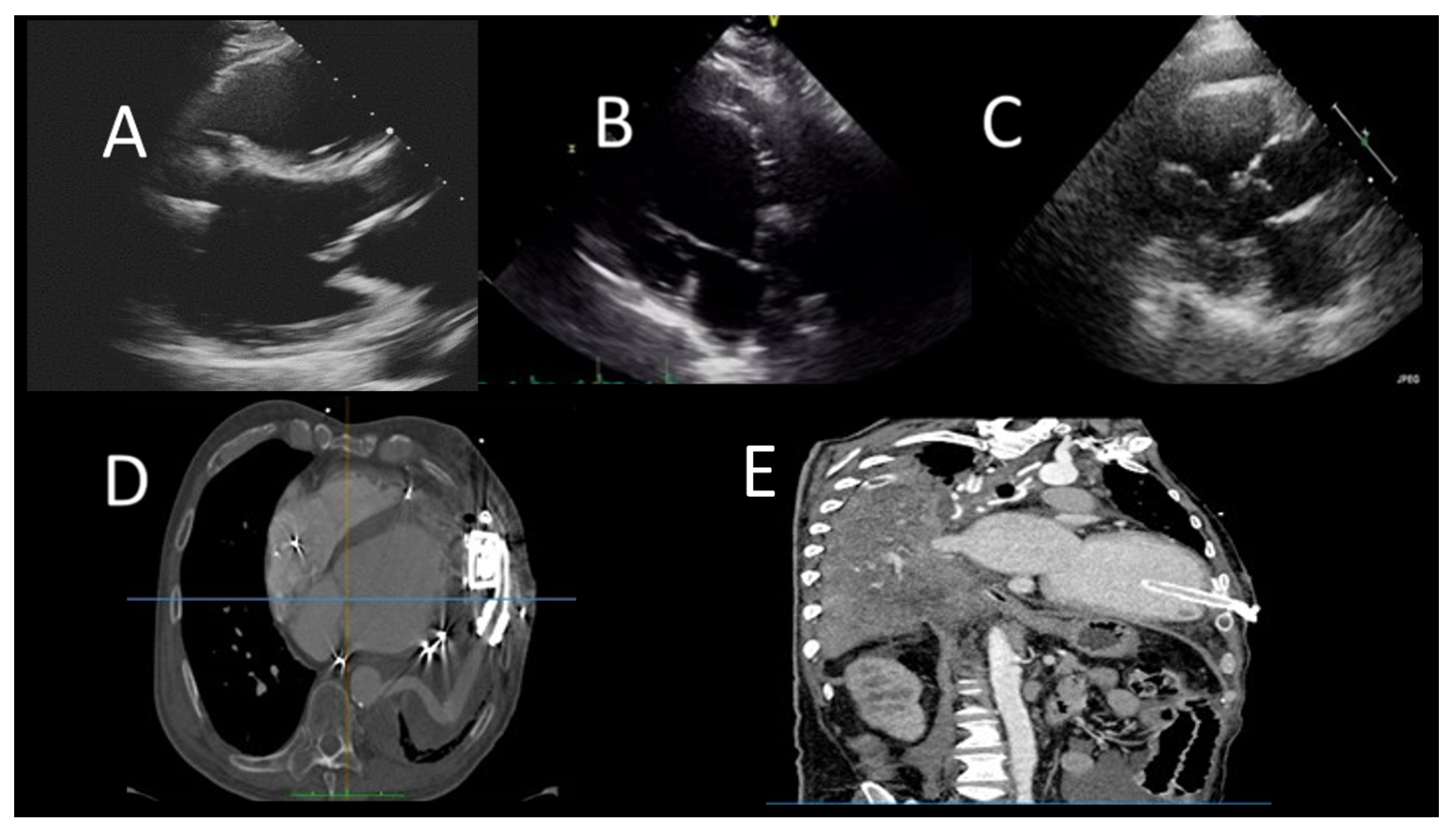 Jcm 12 07641 g005 Jcm 12 07641 g005