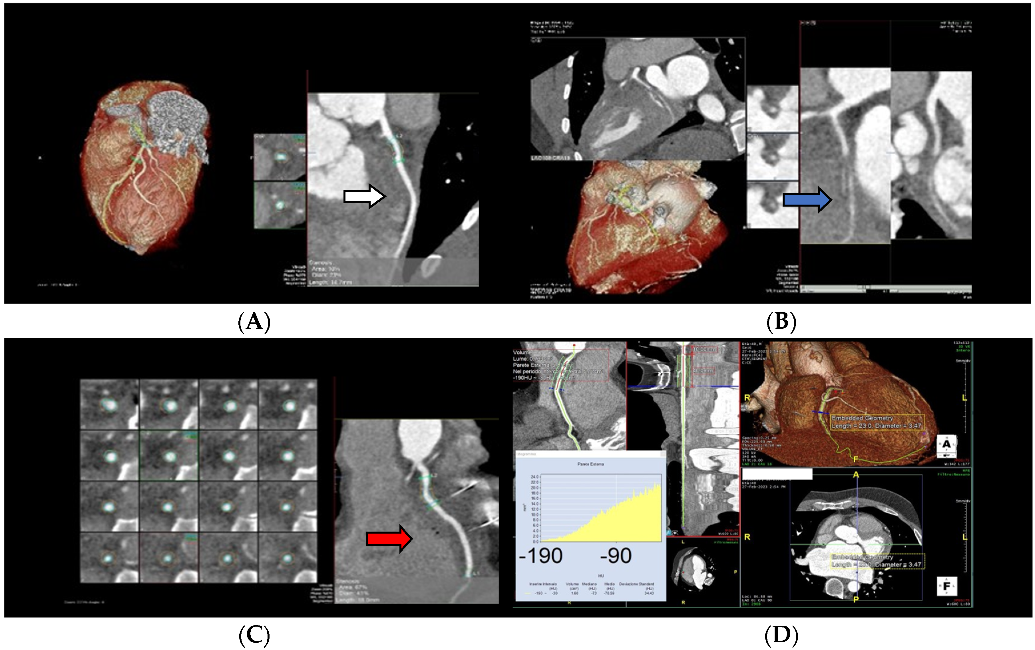 Jcm 12 07641 g007 Jcm 12 07641 g007