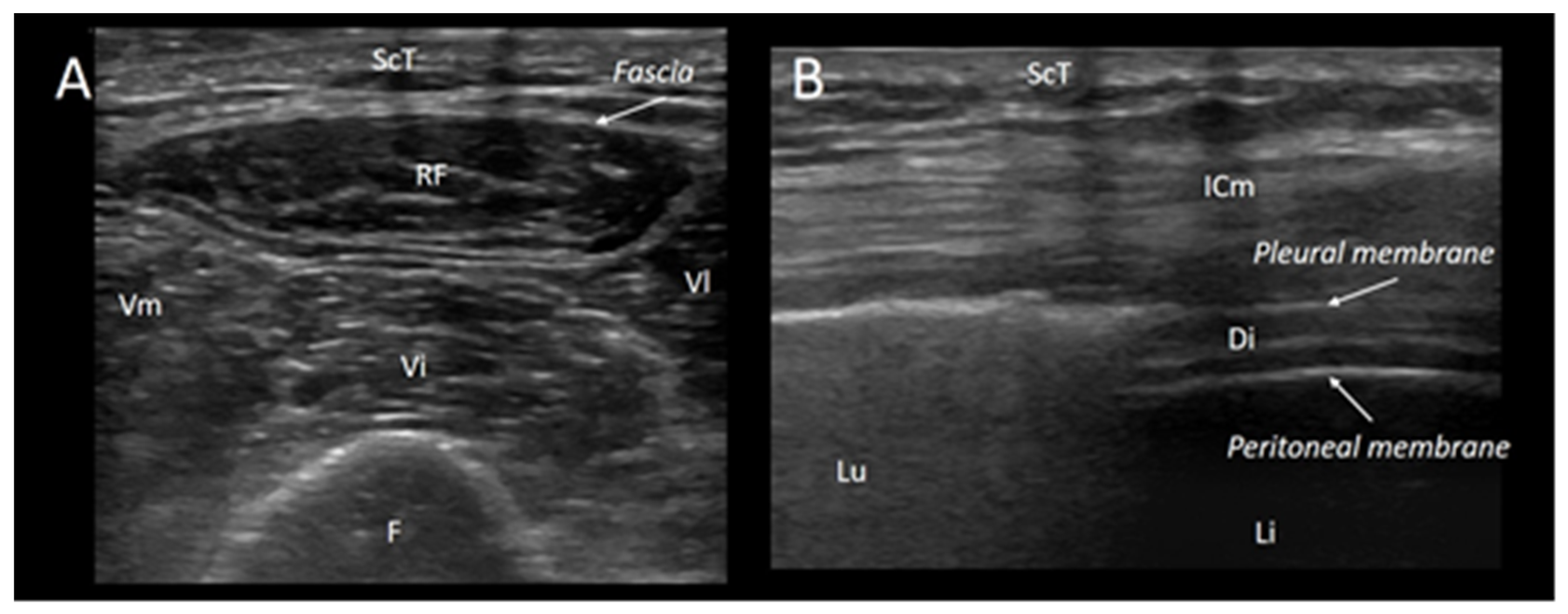 Jcm 13 00026 g001 Jcm 13 00026 g001