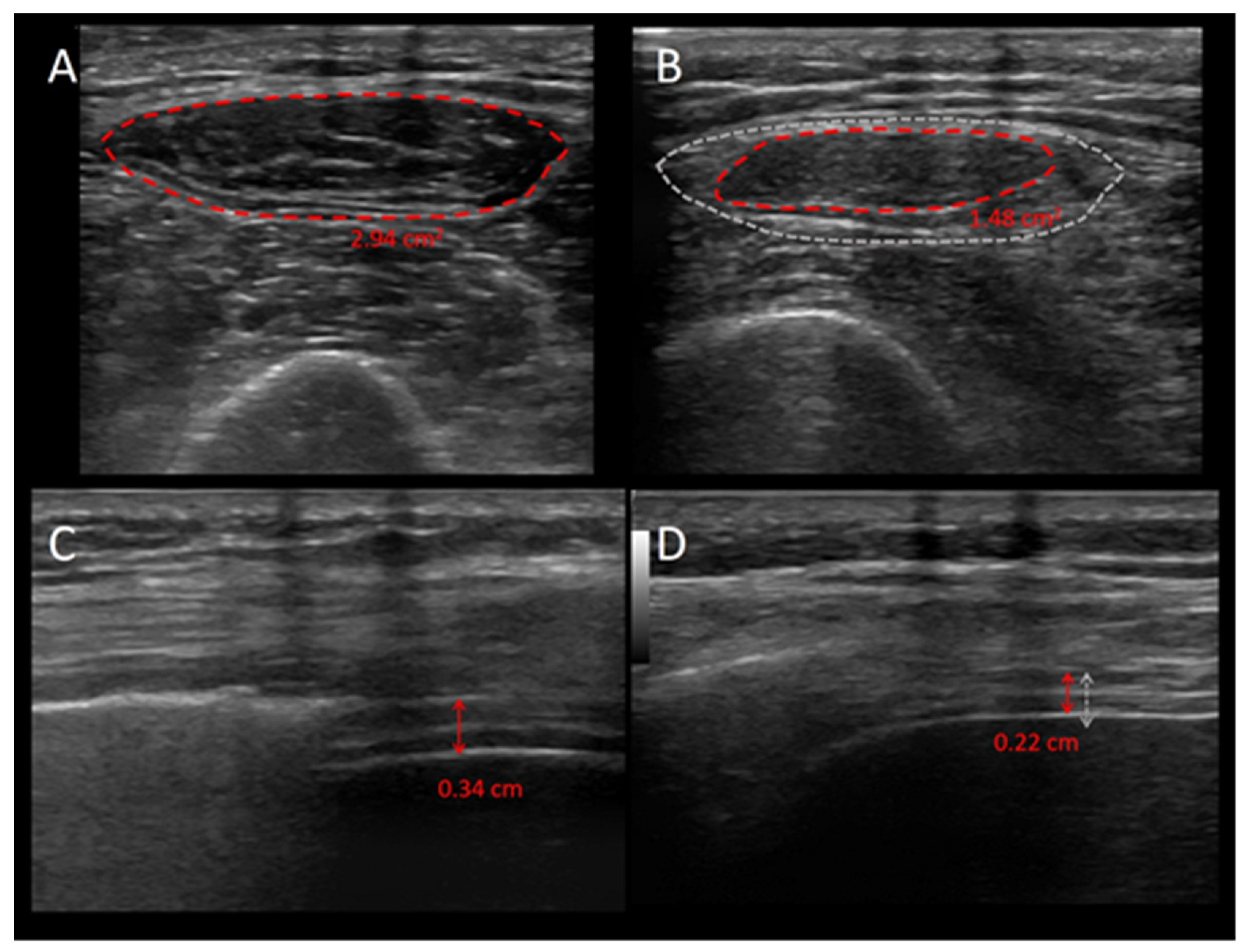Jcm 13 00026 g002 Jcm 13 00026 g002