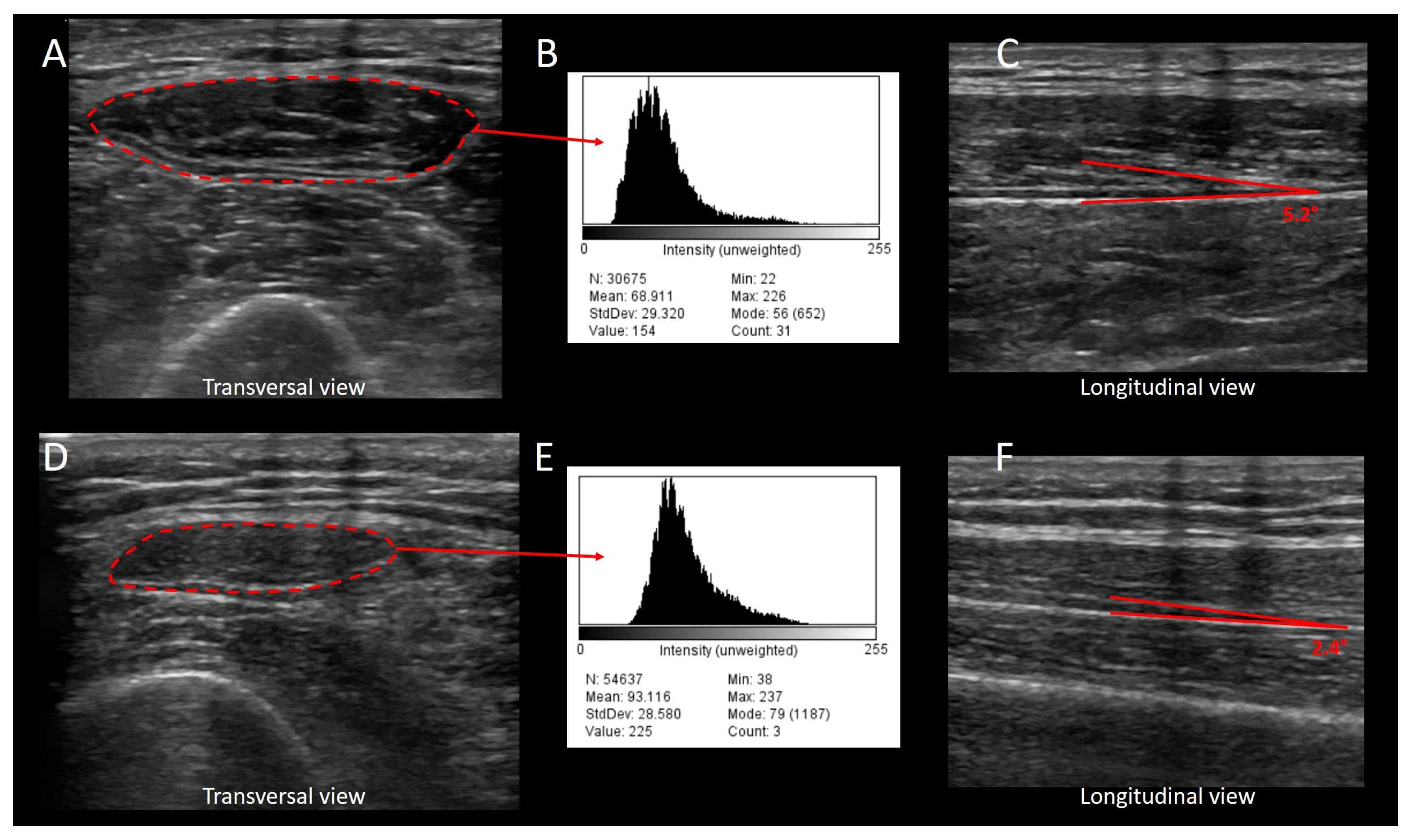 Jcm 13 00026 g003 Jcm 13 00026 g003