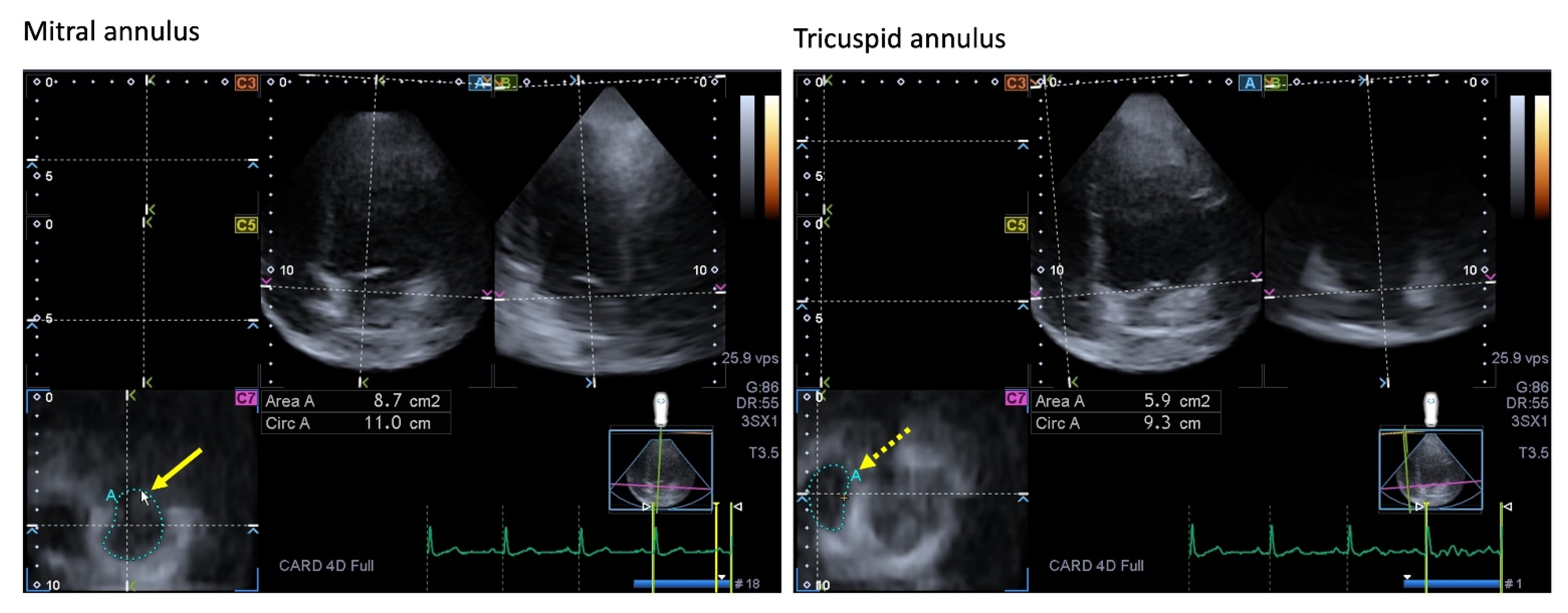 Jcm 13 00078 g004 Jcm 13 00078 g004