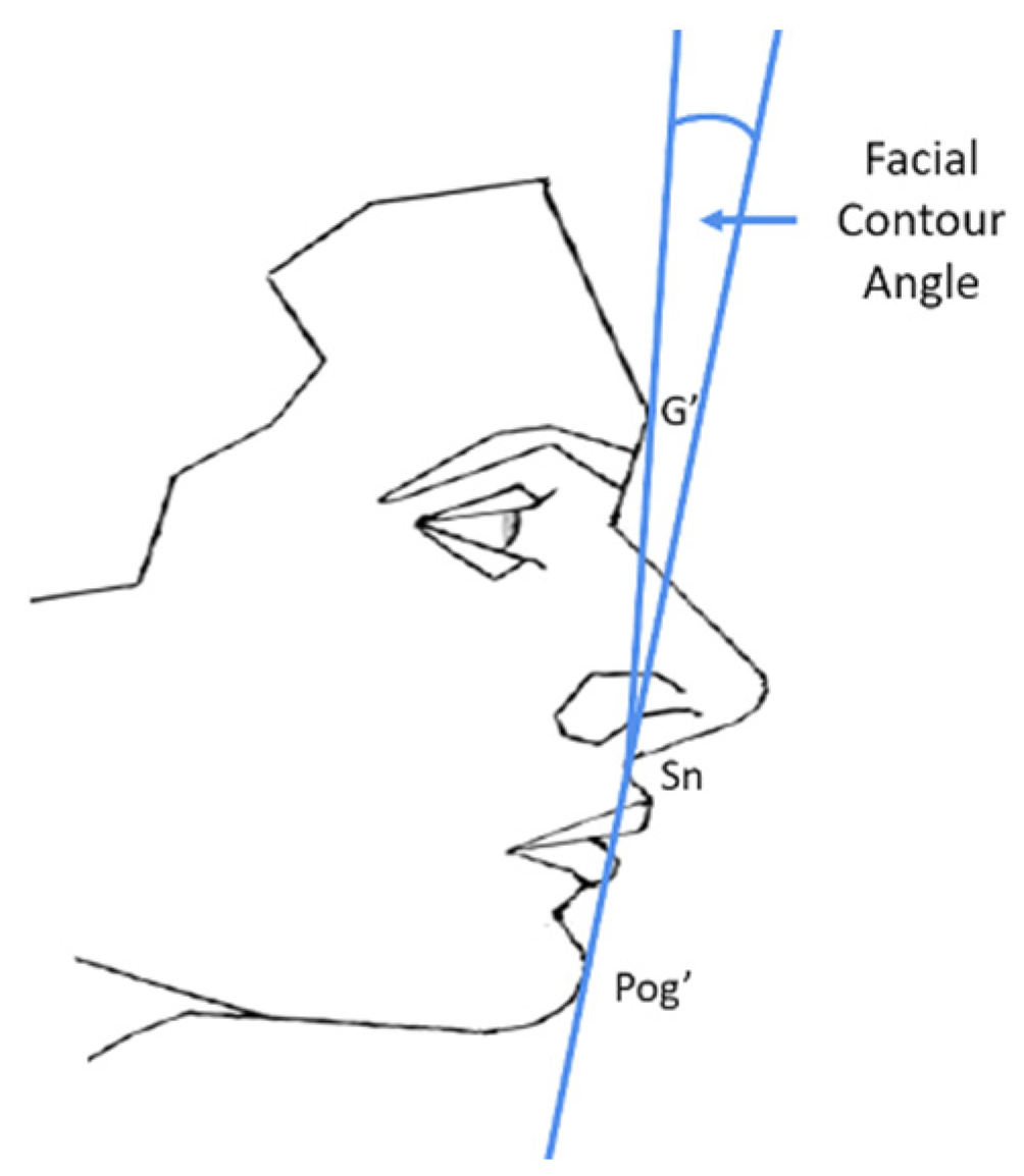 JCM Free FullText Perceived Effects of Orthognathic Surgery versus