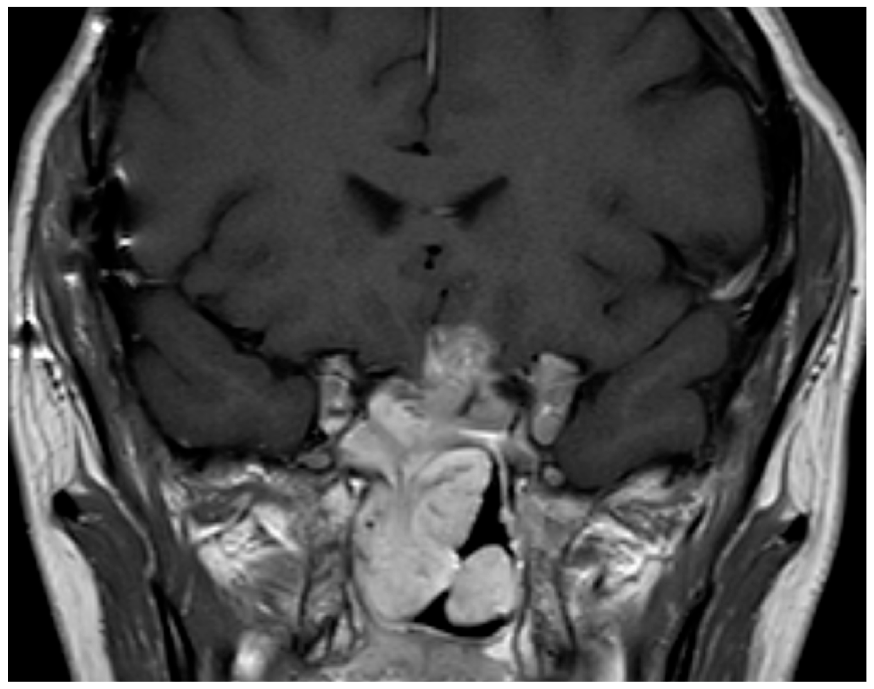 Jcm 13 00116 g001 Jcm 13 00116 g001