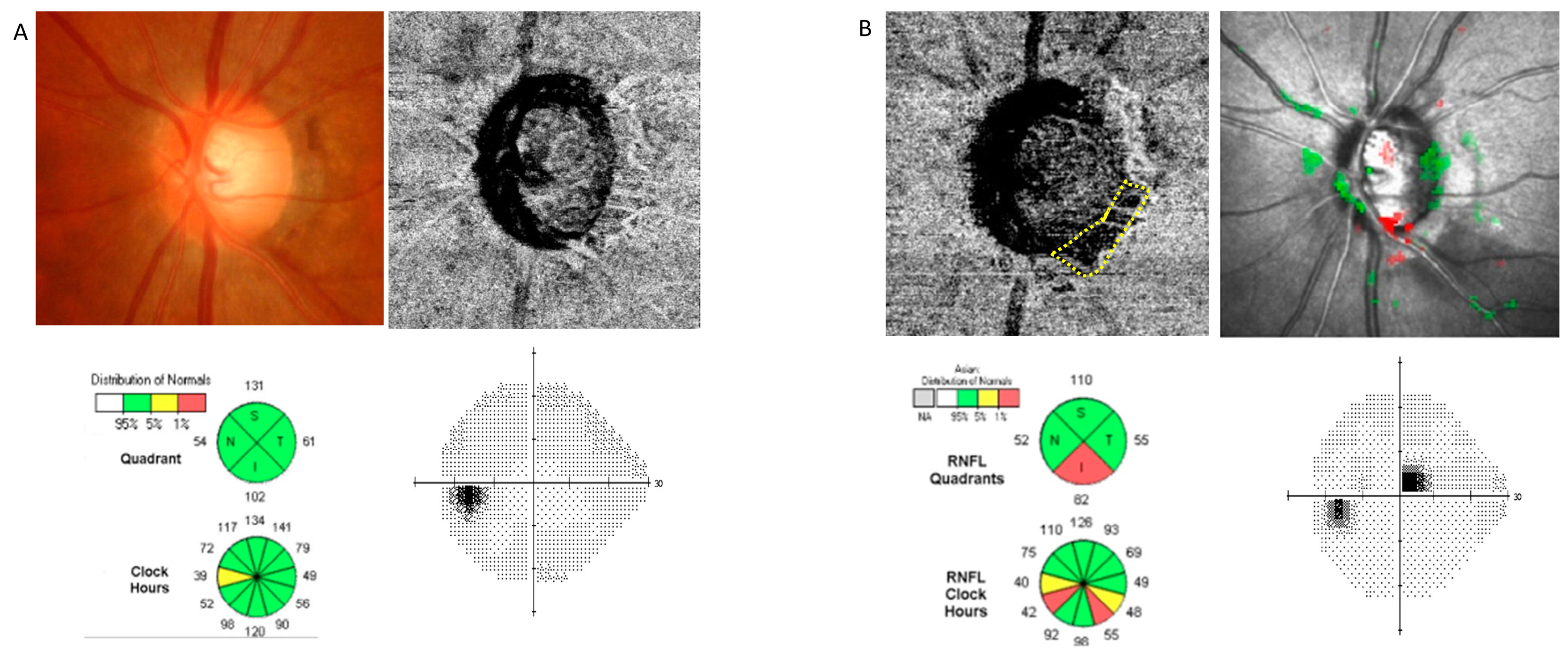 Jcm 13 00204 g001 Jcm 13 00204 g001