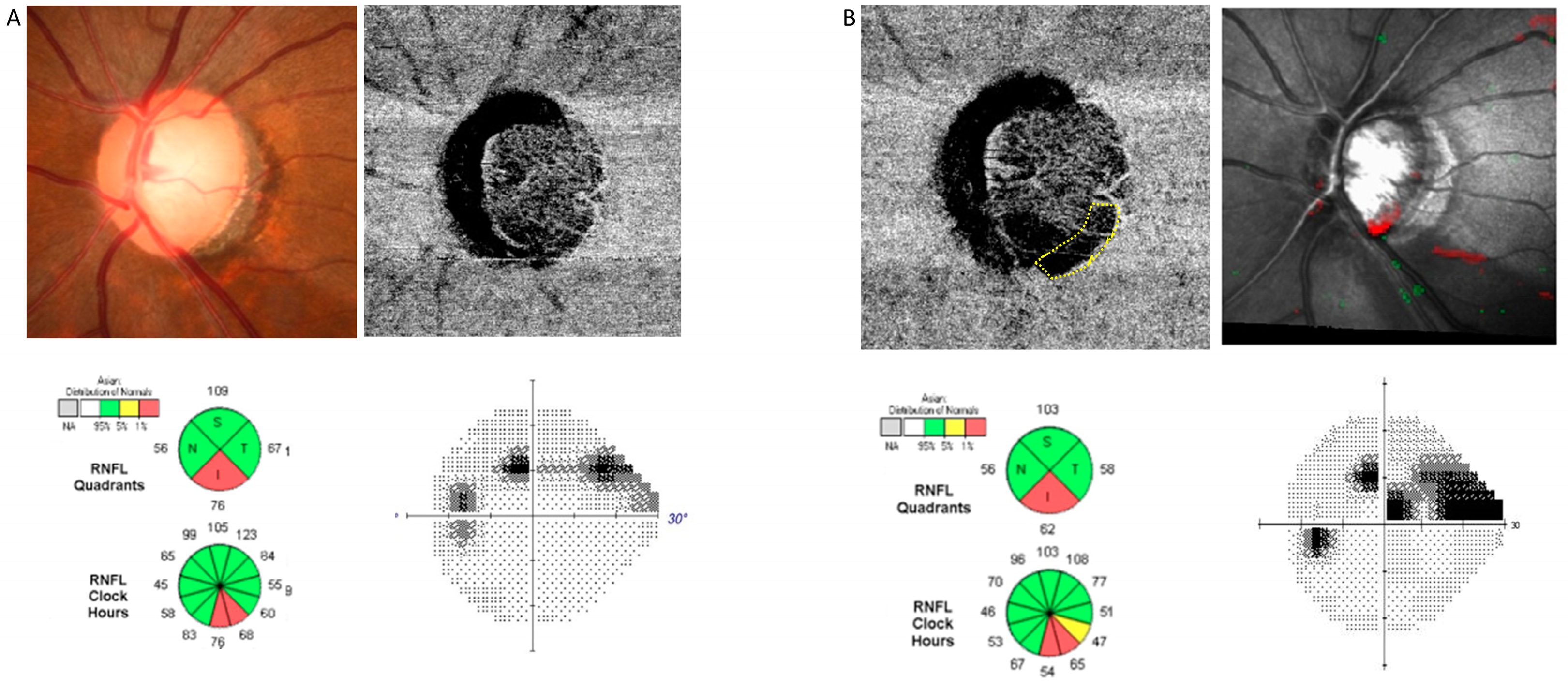 Jcm 13 00204 g002 Jcm 13 00204 g002
