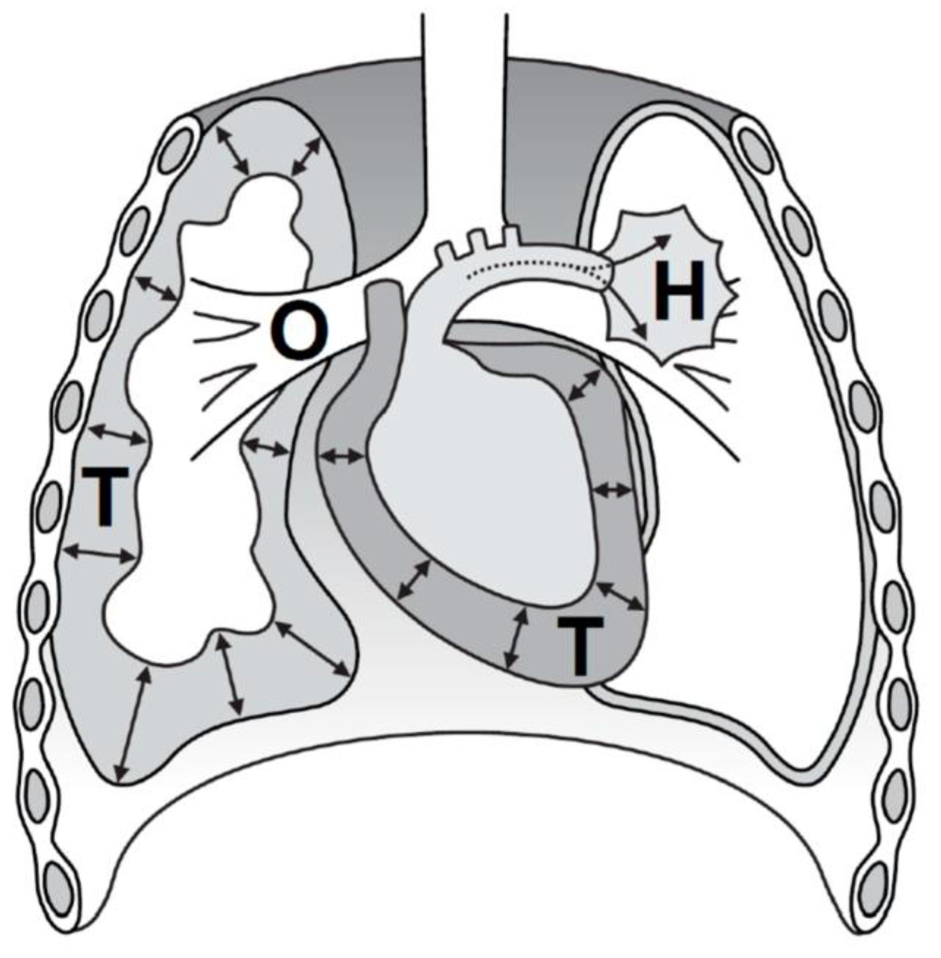 The four basic sleeping positions (image source at www.paramedicine.com/)