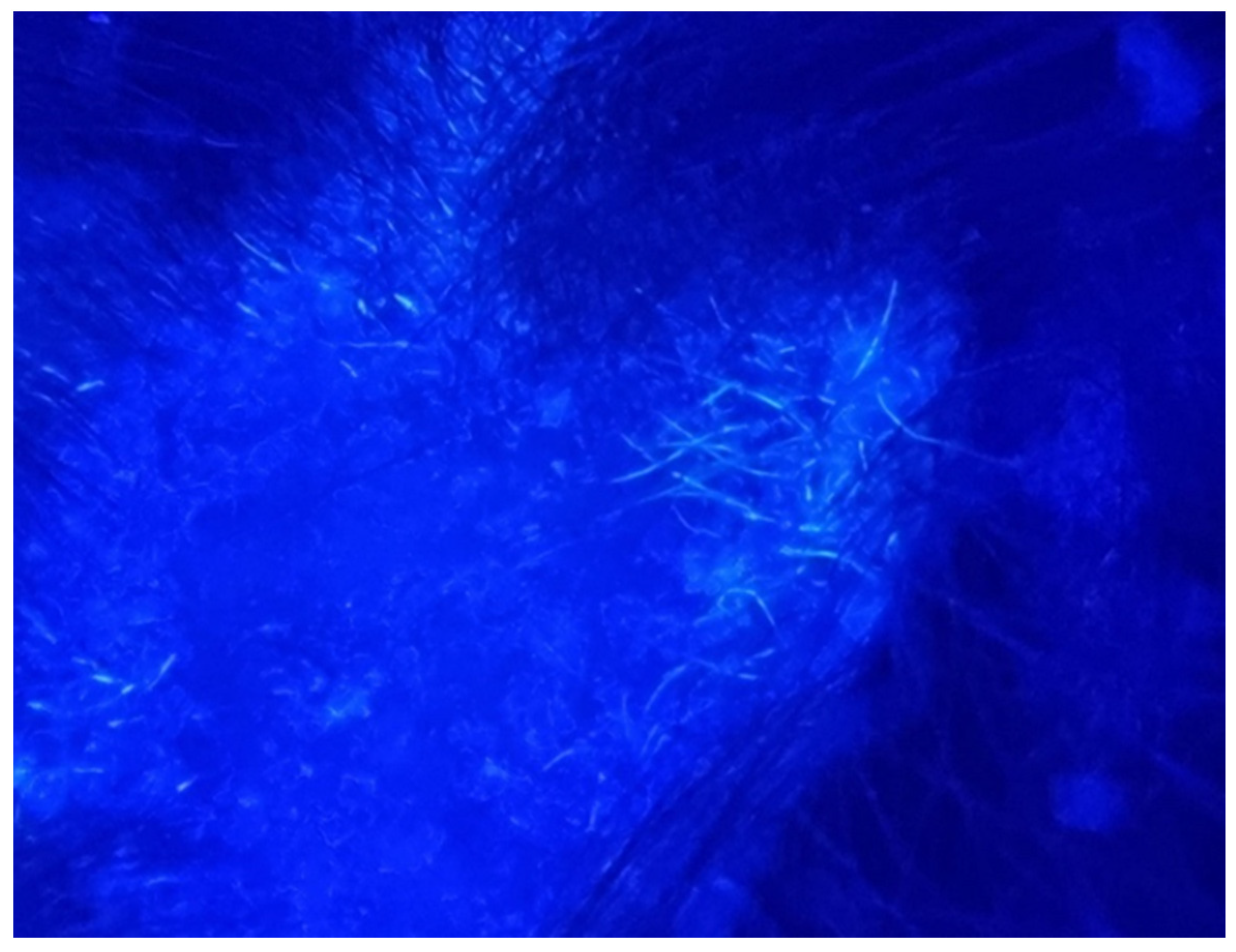 Jcm 13 00376 g003 Jcm 13 00376 g003