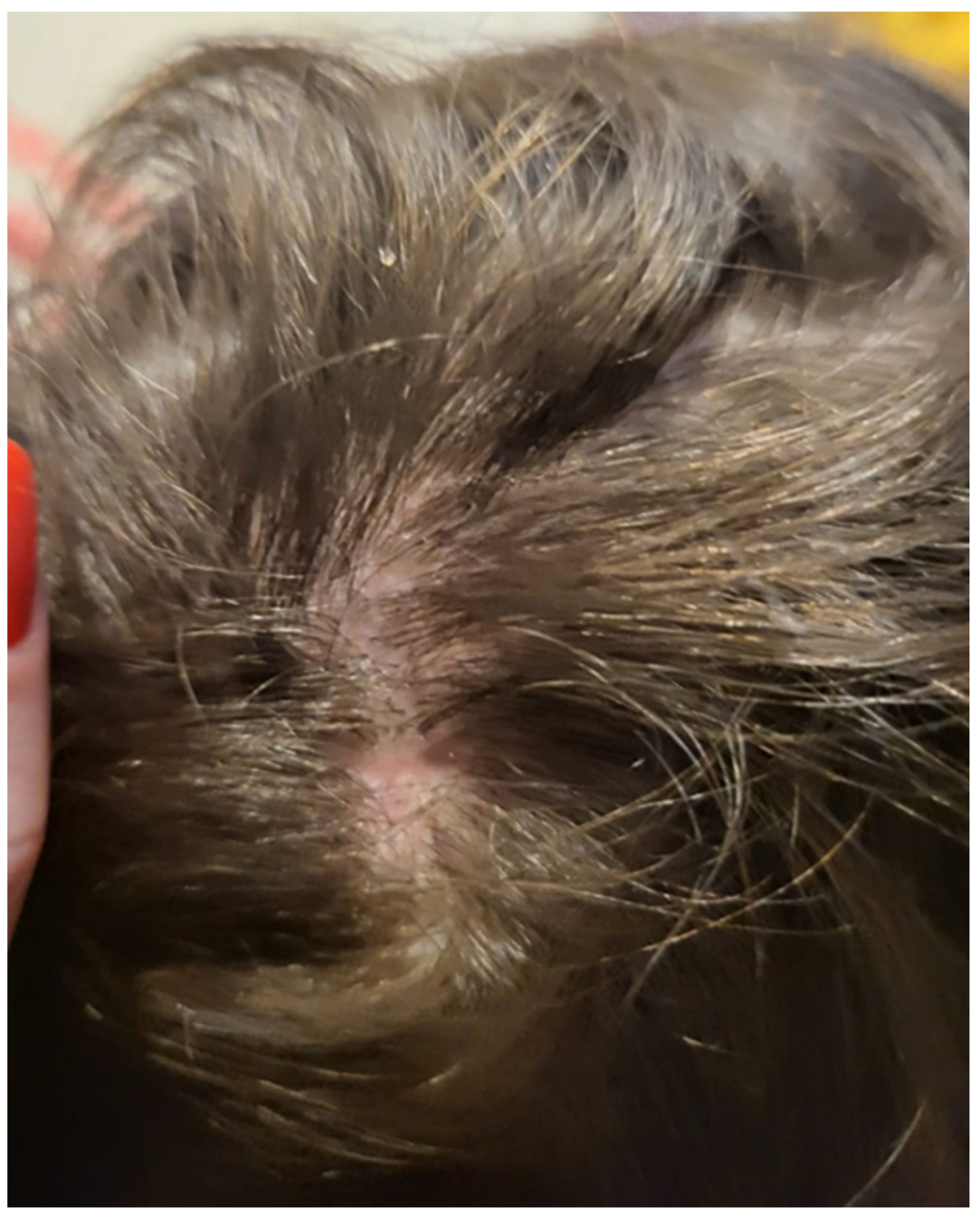 Jcm 13 00376 g005 Jcm 13 00376 g005