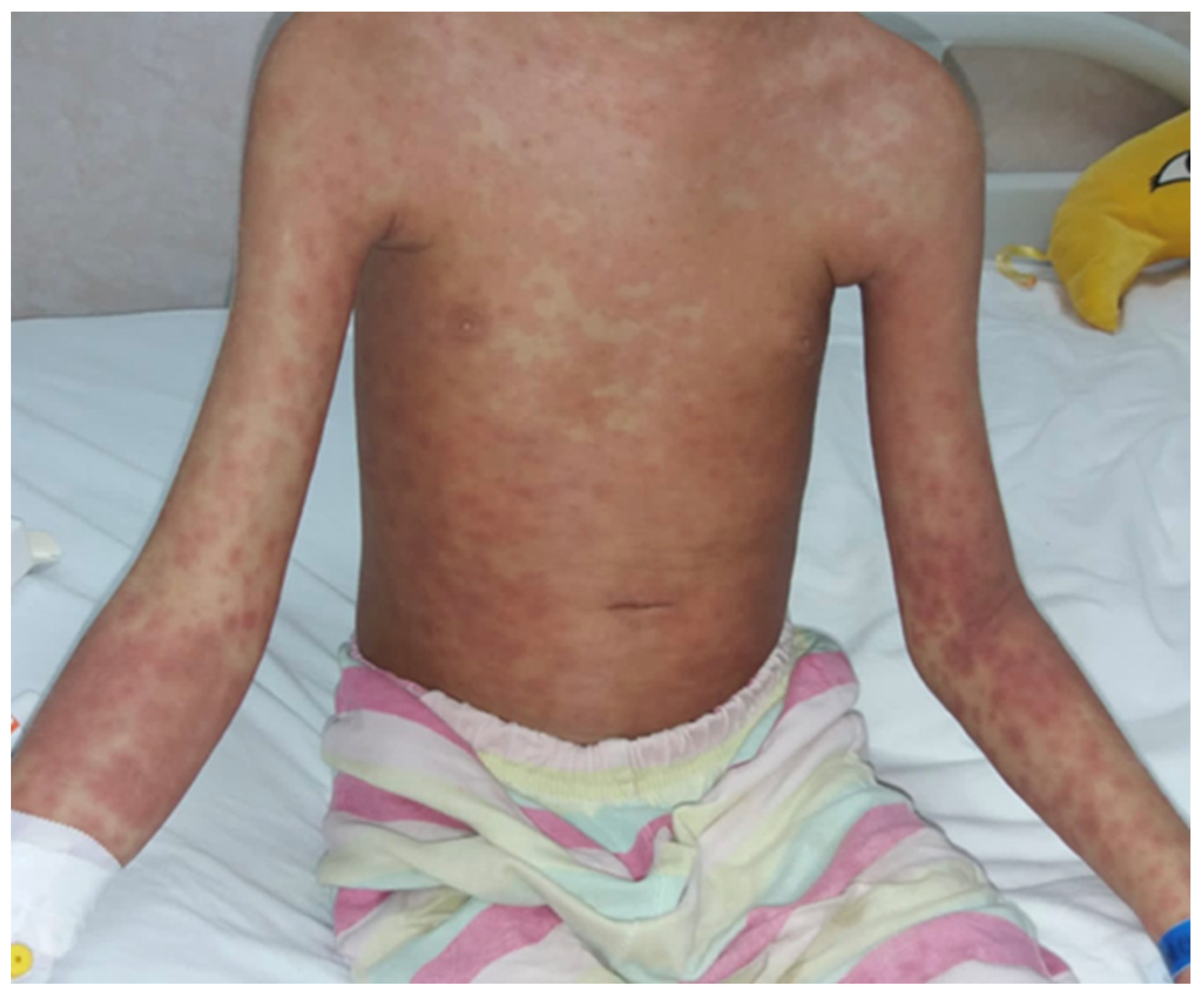 Jcm 13 00376 g008 Jcm 13 00376 g008