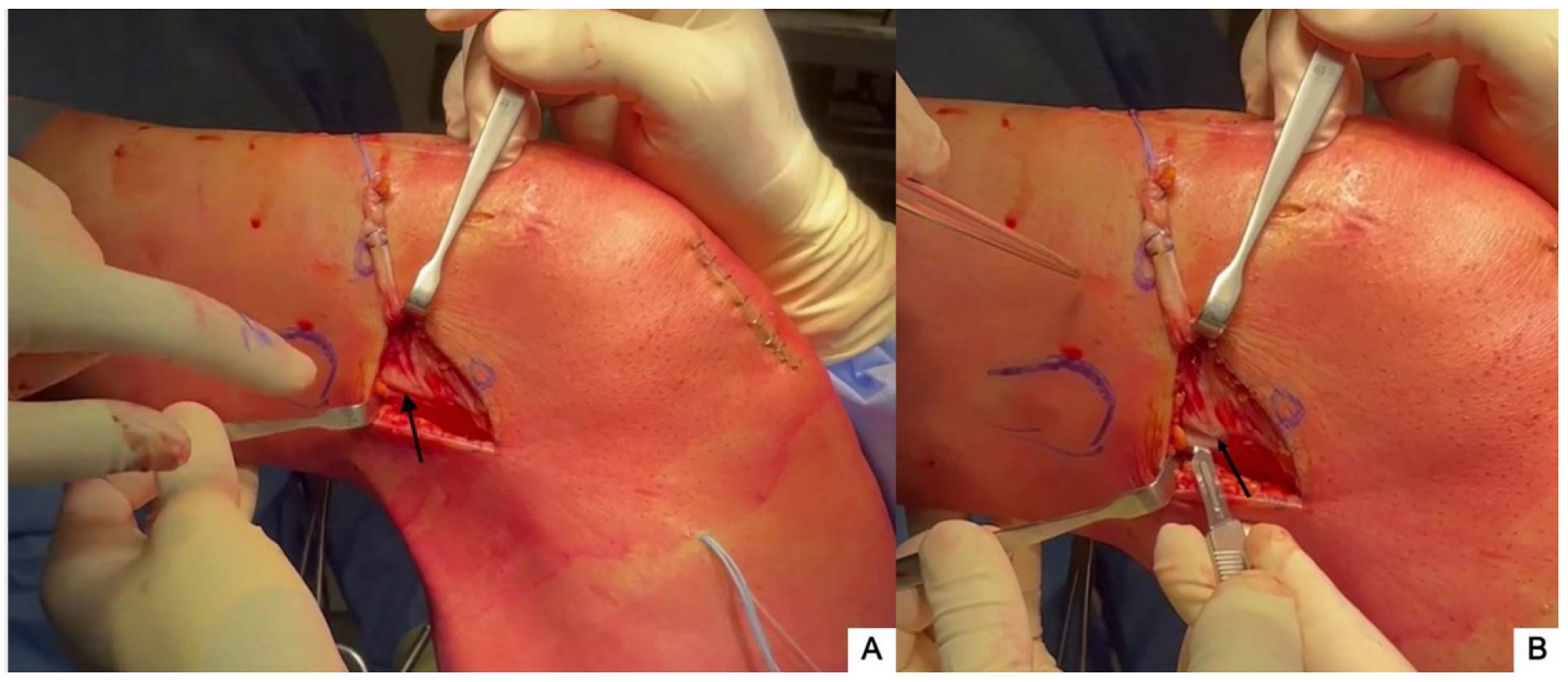 Jcm 13 00377 g003 Jcm 13 00377 g003