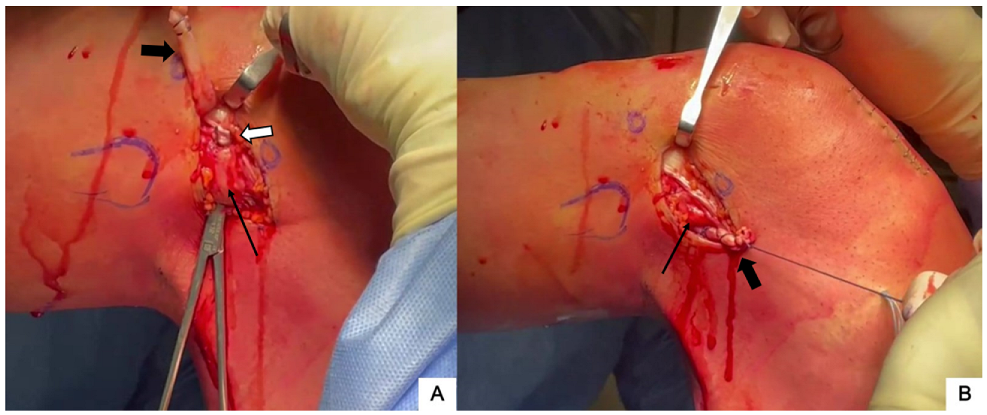 Jcm 13 00377 g004 Jcm 13 00377 g004