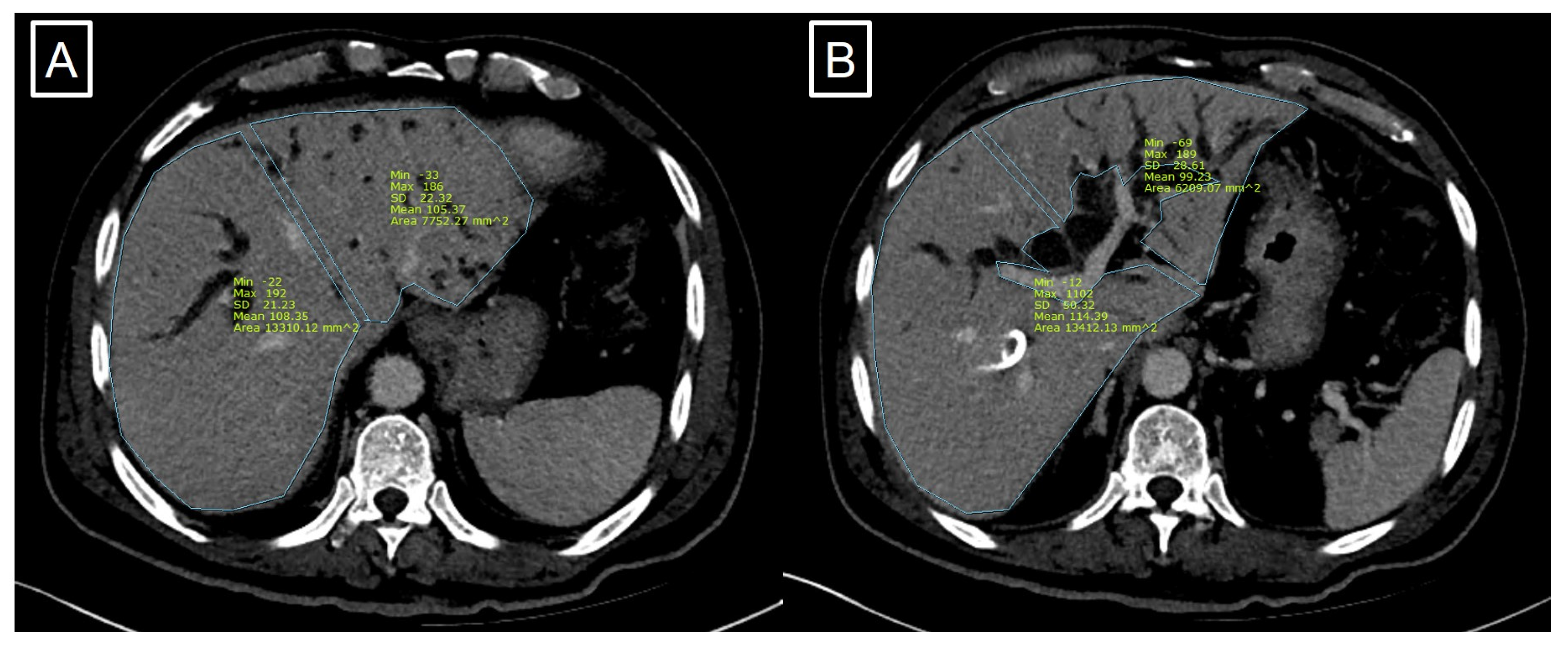 Jcm 13 00381 g002 Jcm 13 00381 g002