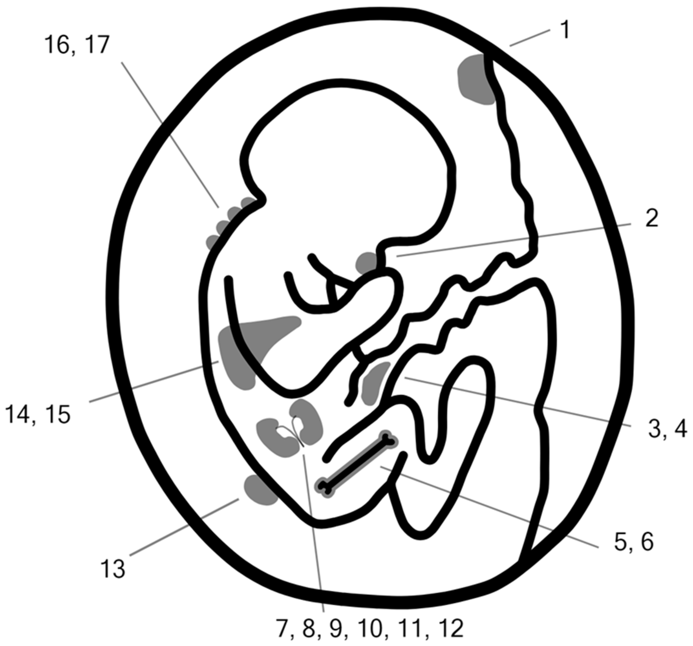 JCM | Free Full-Text | Fetal and Placental Causes of Elevated Serum ...