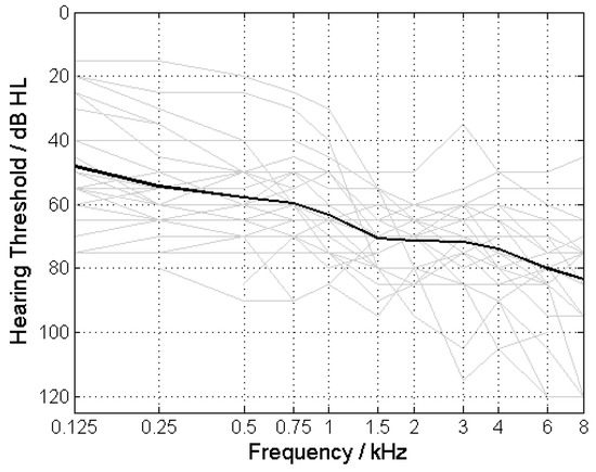 Tone Decay Reconsidered: Preliminary Results of a Prospective Study in ...