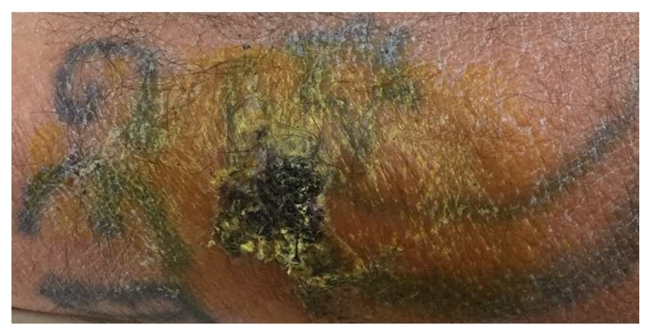 Jcm 13 00503 g002 Jcm 13 00503 g002