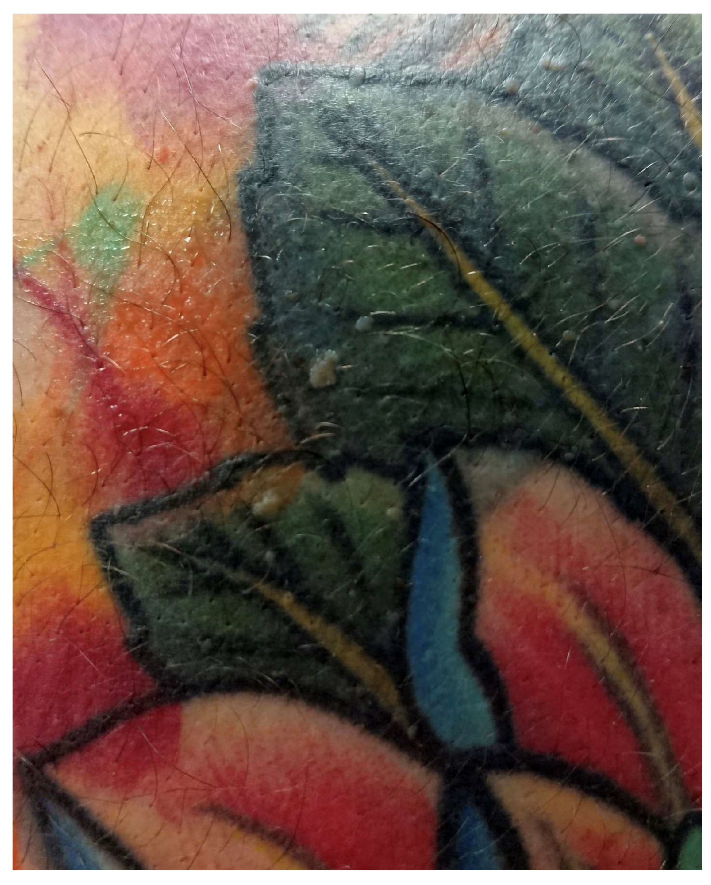 Jcm 13 00503 g006 Jcm 13 00503 g006