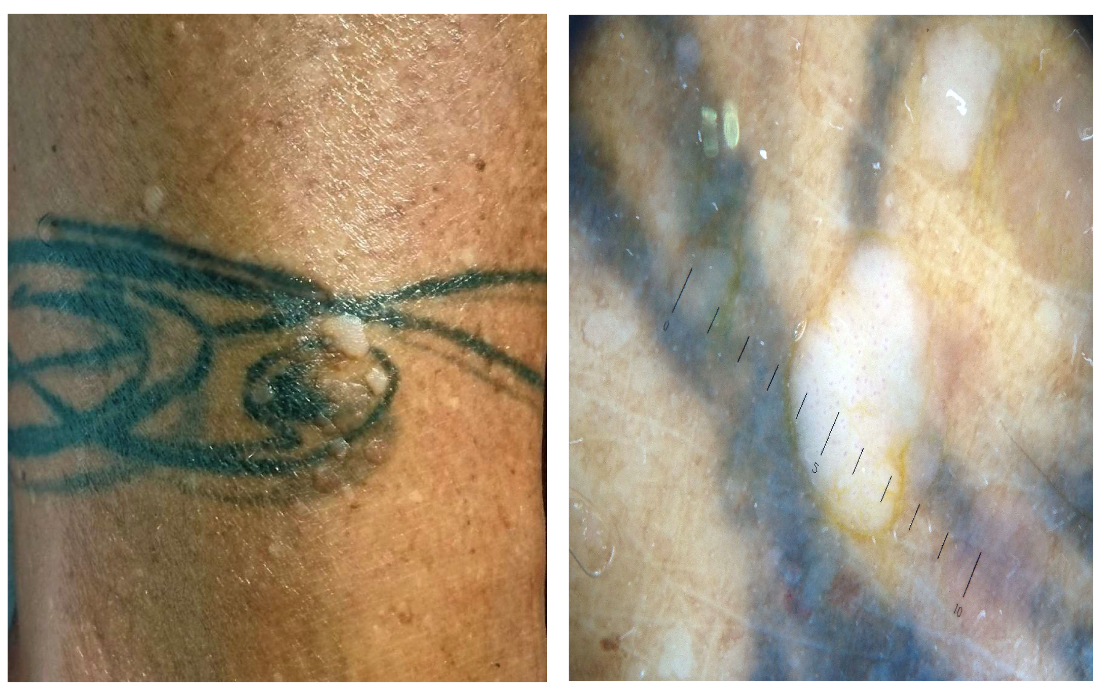 Jcm 13 00503 g007 Jcm 13 00503 g007