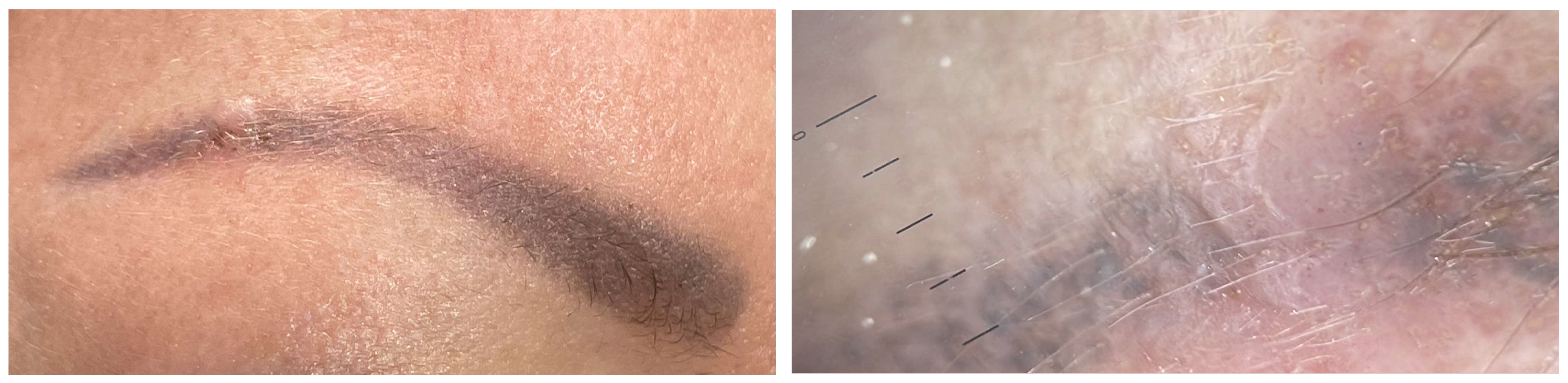 Jcm 13 00503 g008 Jcm 13 00503 g008