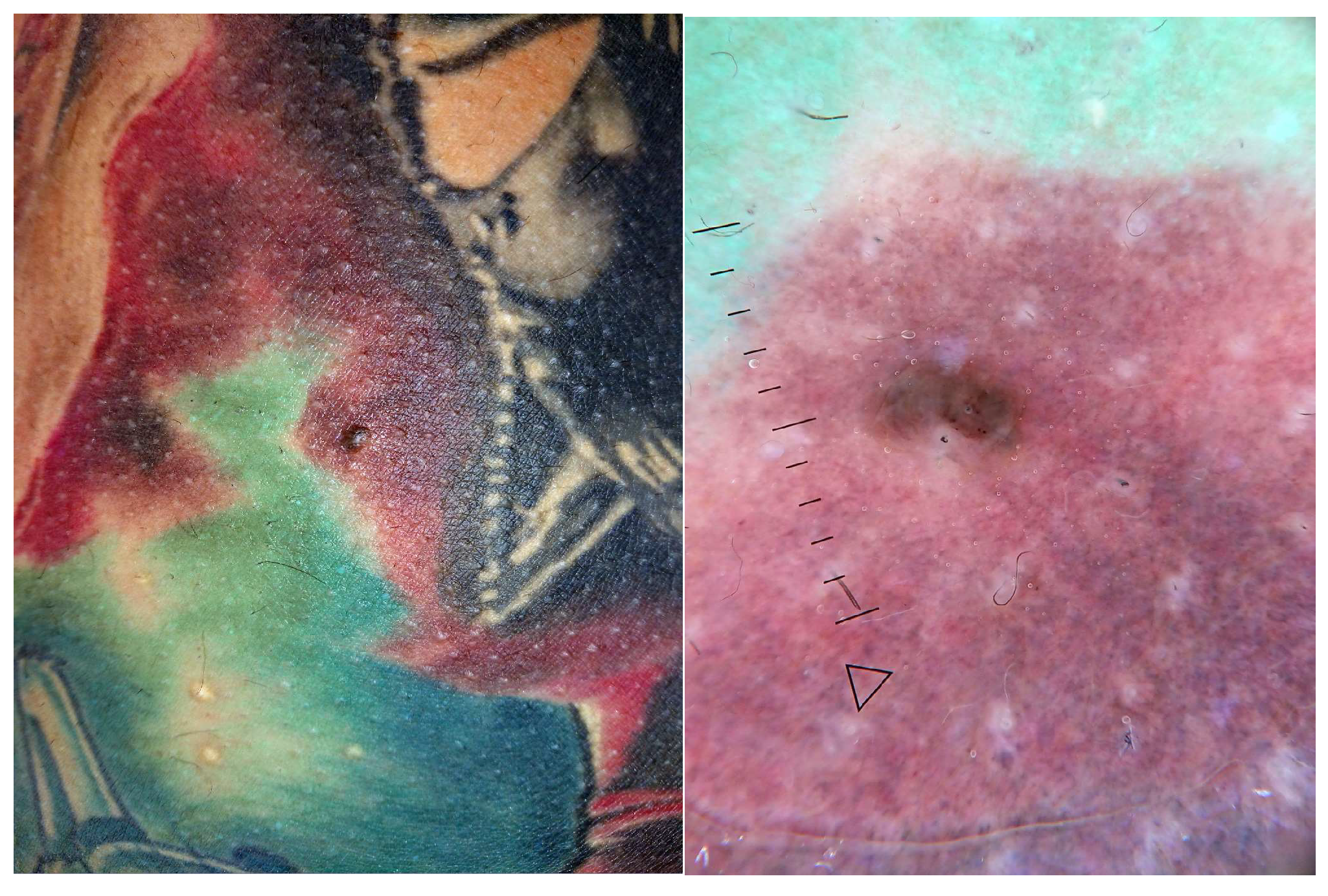 Jcm 13 00503 g010 Jcm 13 00503 g010