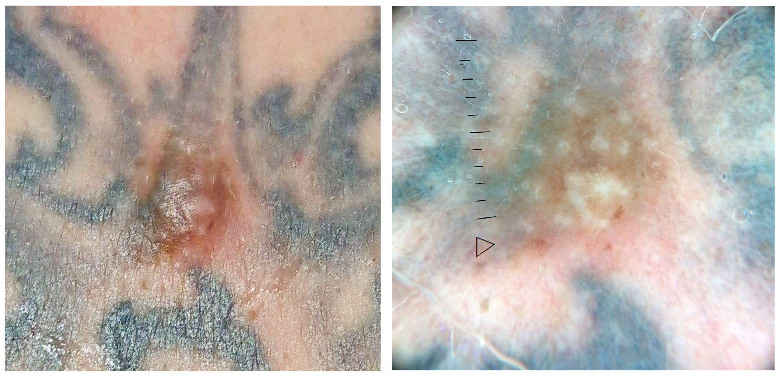 Jcm 13 00503 g011 Jcm 13 00503 g011