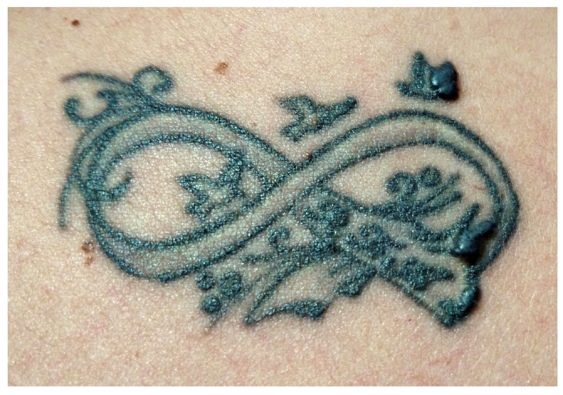 Jcm 13 00503 g012 Jcm 13 00503 g012