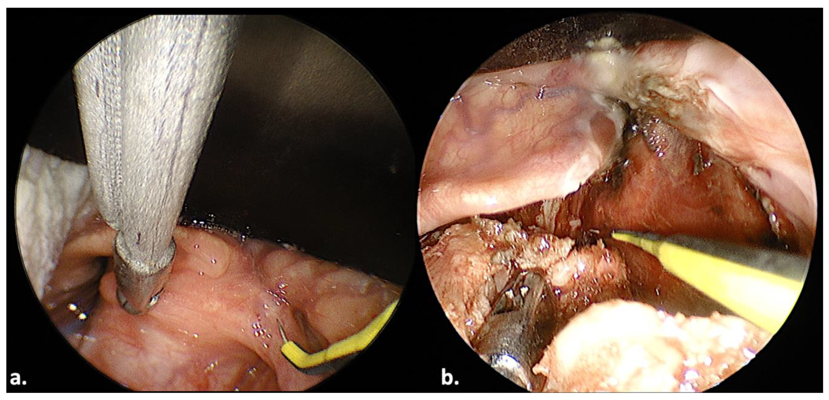 Jcm 13 00507 g003 Jcm 13 00507 g003