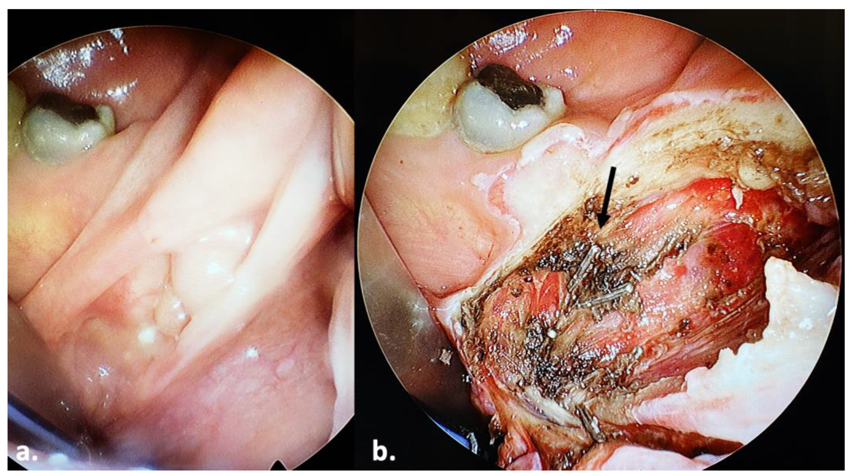 Jcm 13 00507 g004 Jcm 13 00507 g004