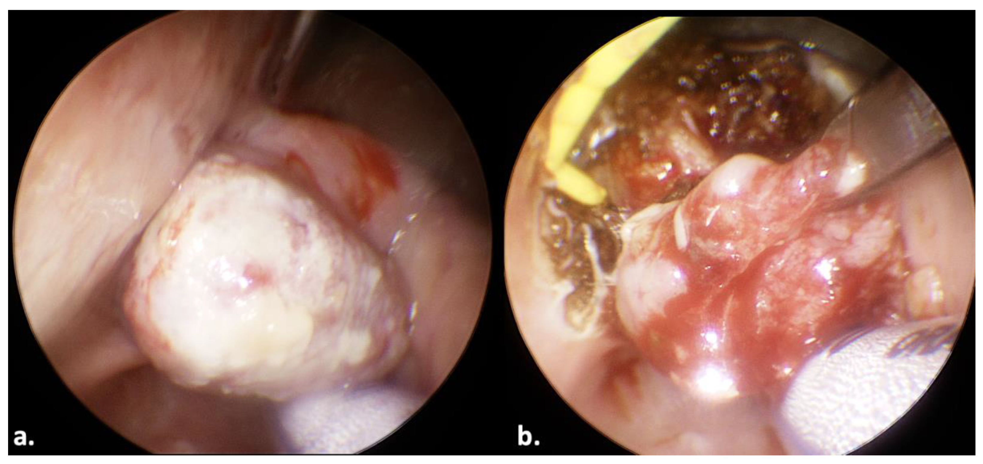 Jcm 13 00507 g005 Jcm 13 00507 g005