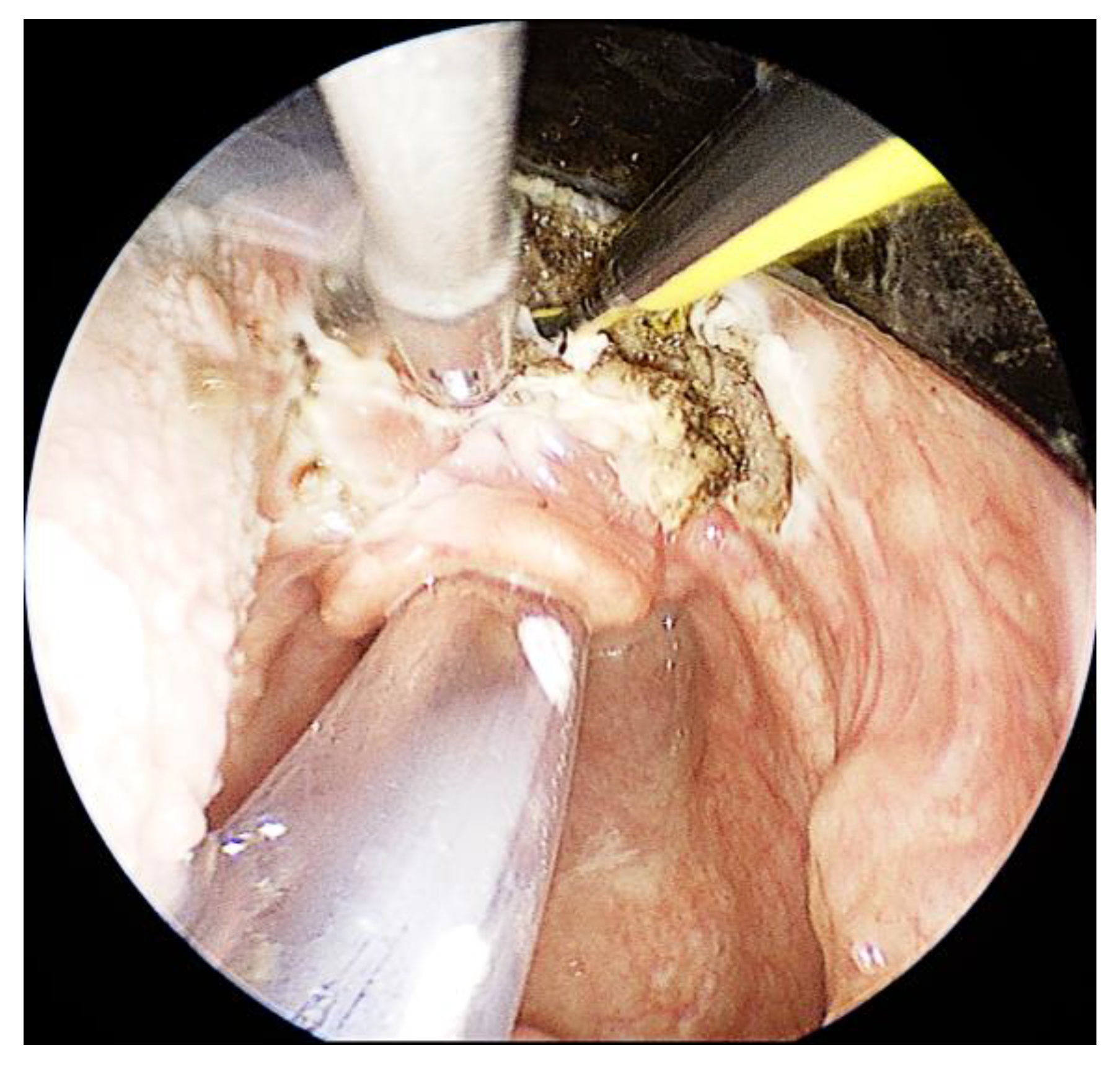 Jcm 13 00507 g006 Jcm 13 00507 g006