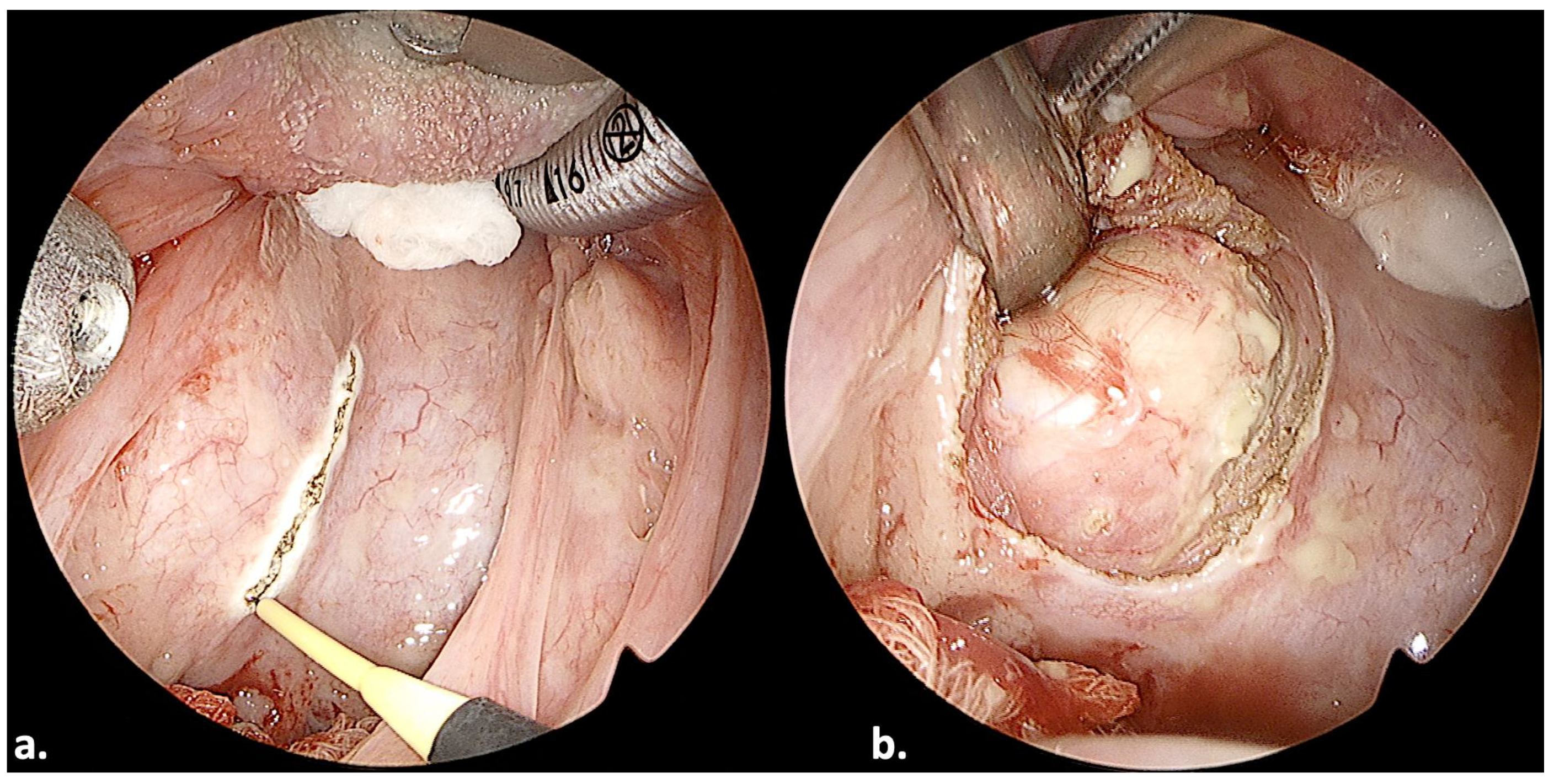 Jcm 13 00507 g007 Jcm 13 00507 g007