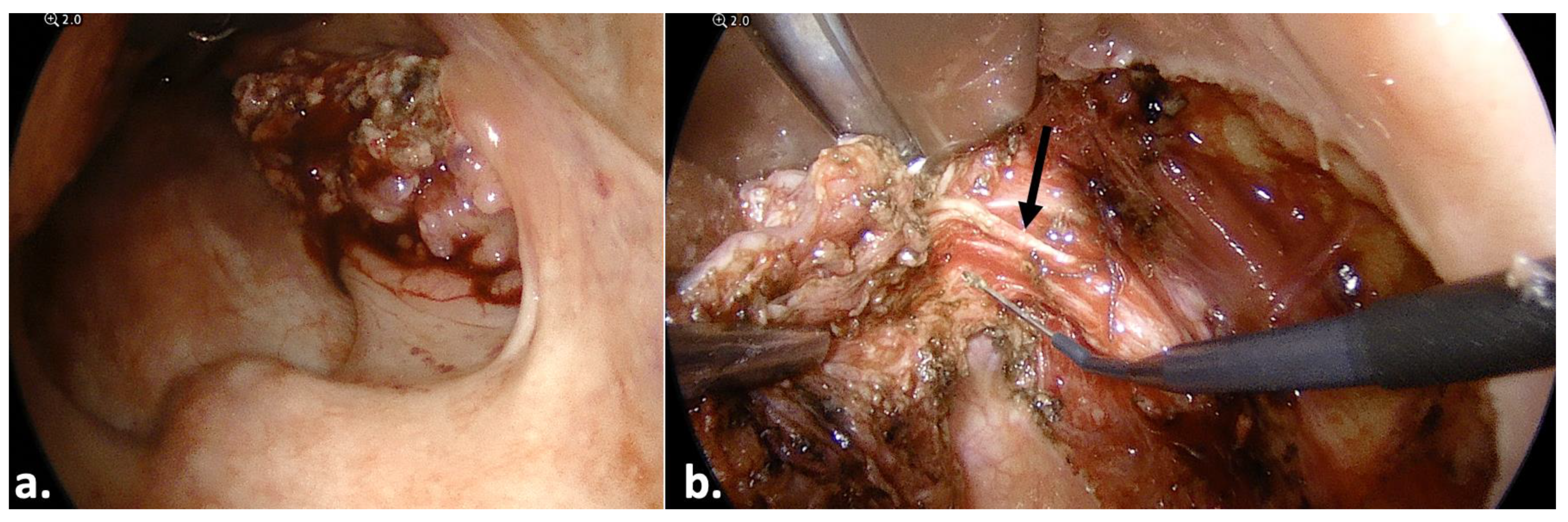 Jcm 13 00507 g008 Jcm 13 00507 g008