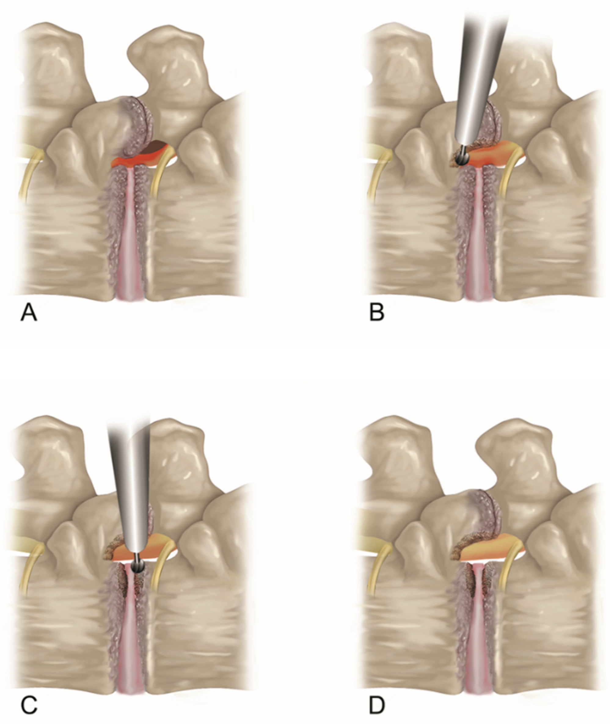 Jcm 13 00515 g001 Jcm 13 00515 g001