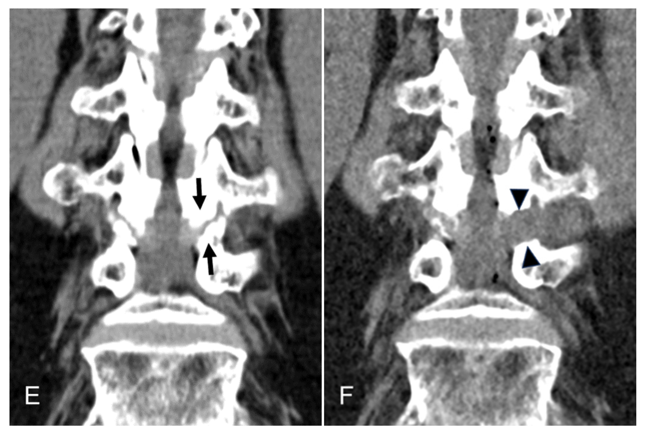 Jcm 13 00515 g003b Jcm 13 00515 g003b