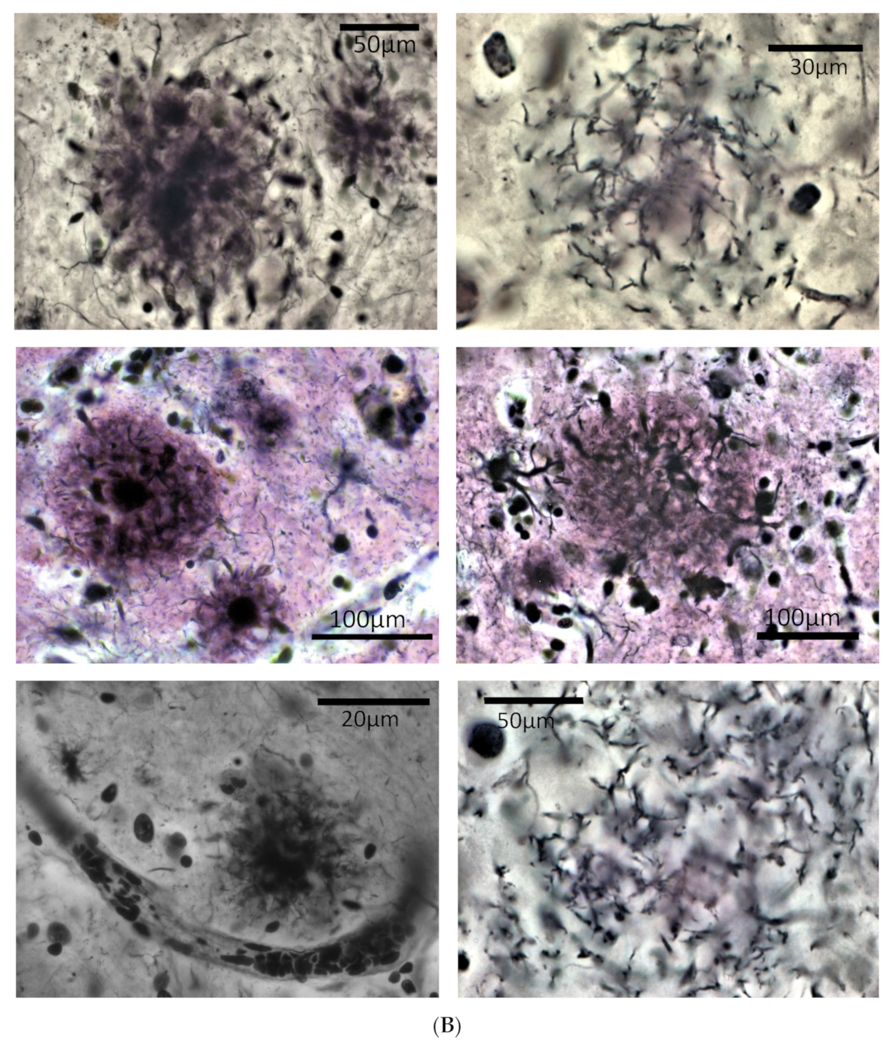 Jcm 13 00536 g002b Jcm 13 00536 g002b