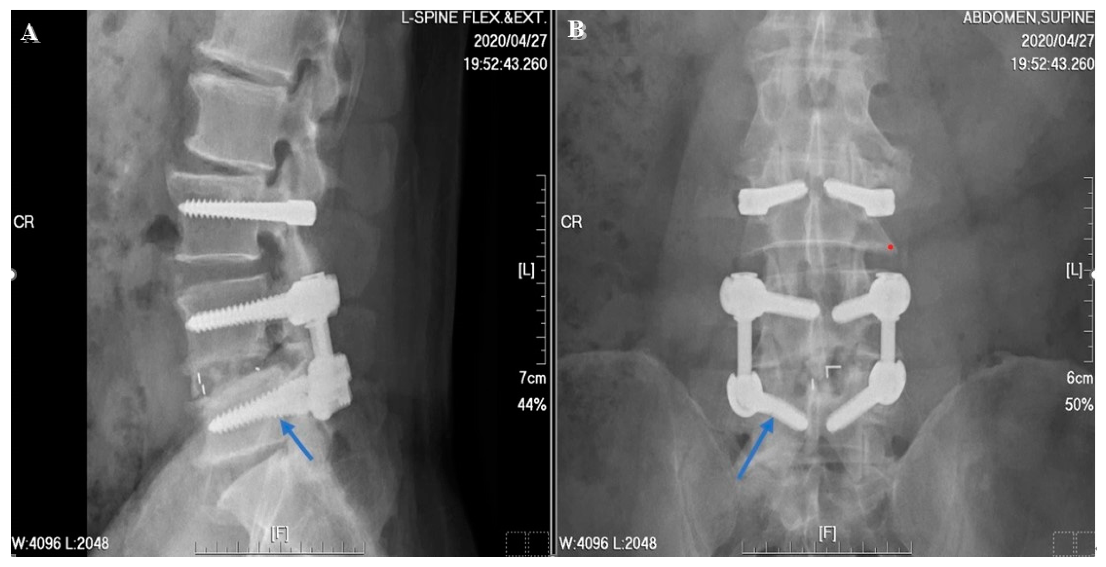 Jcm 13 00582 g008 Jcm 13 00582 g008