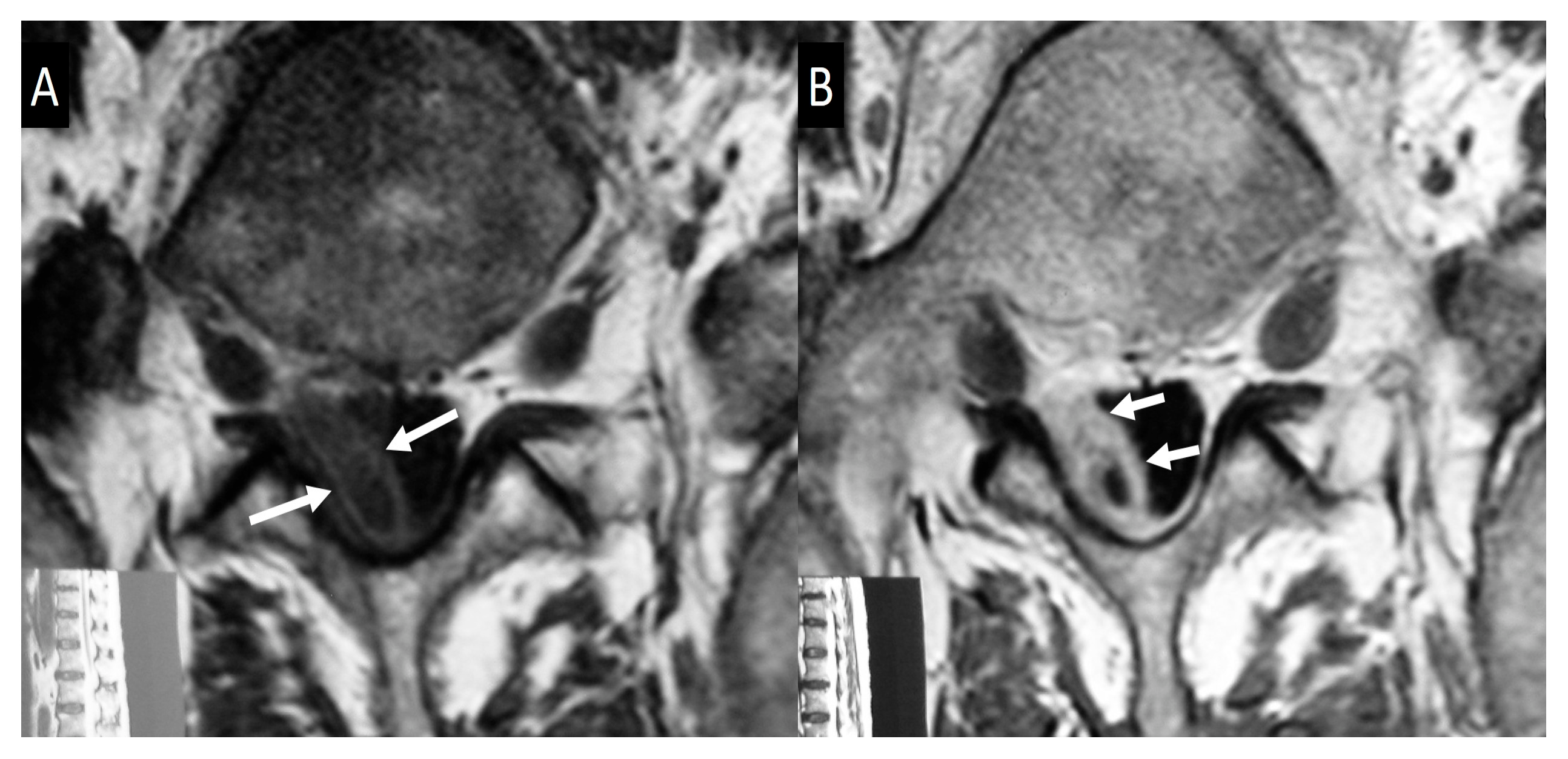 Jcm 13 00595 g003 Jcm 13 00595 g003