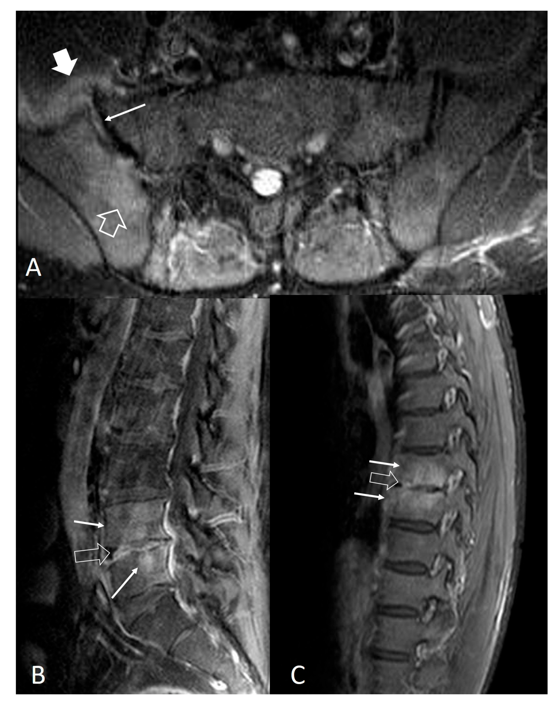 Jcm 13 00595 g004 Jcm 13 00595 g004