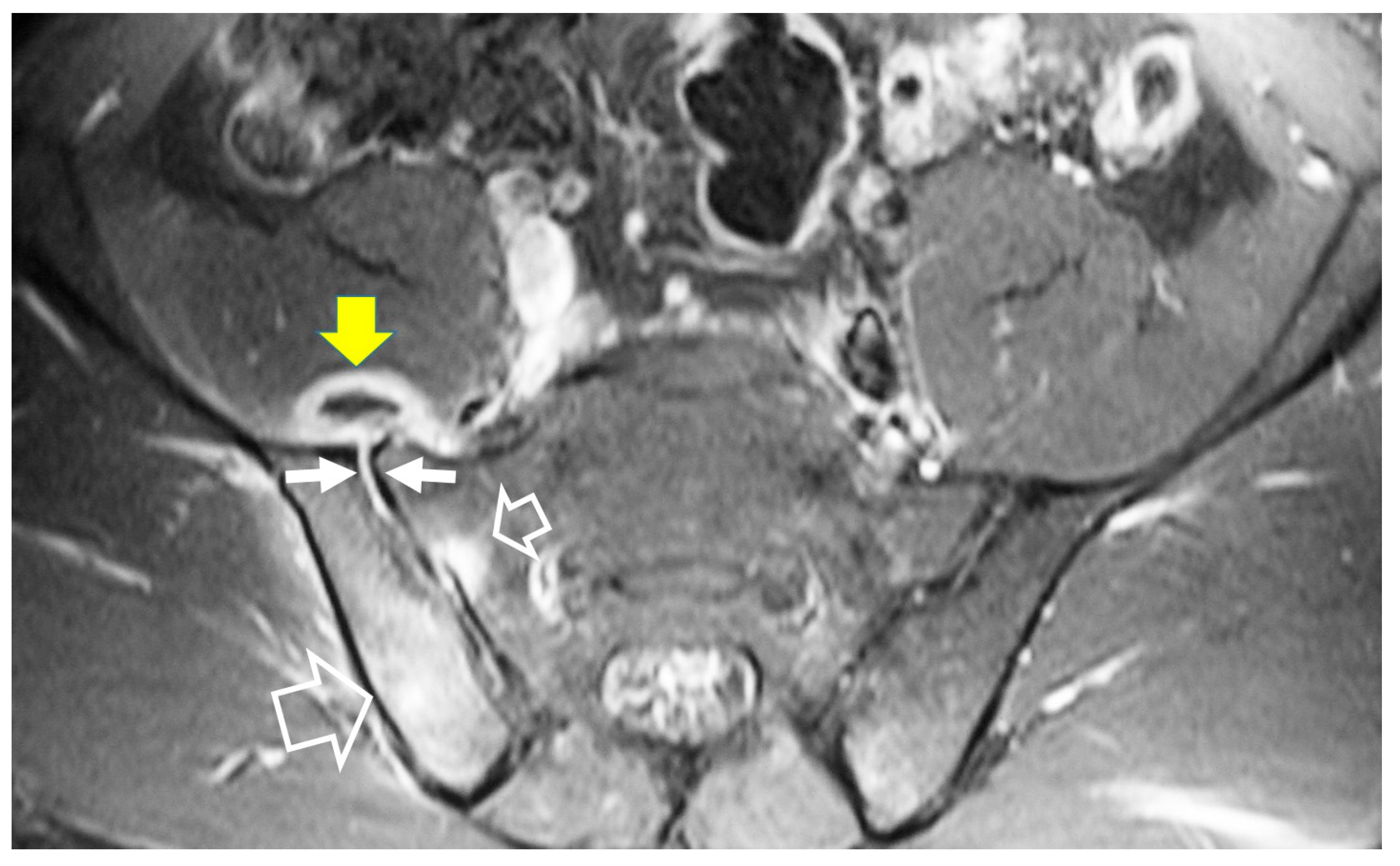 Jcm 13 00595 g005 Jcm 13 00595 g005
