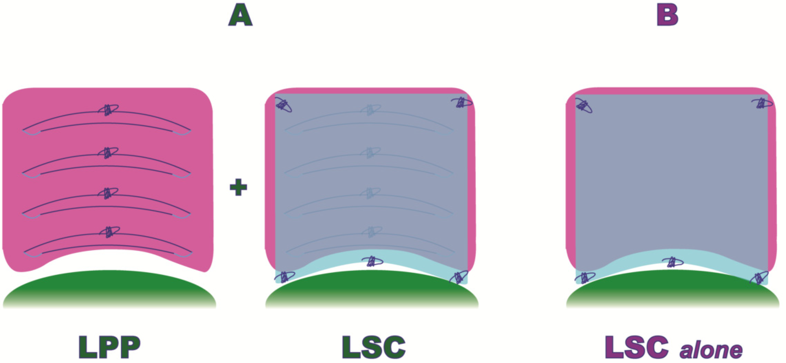 Uterosacral colpopexy