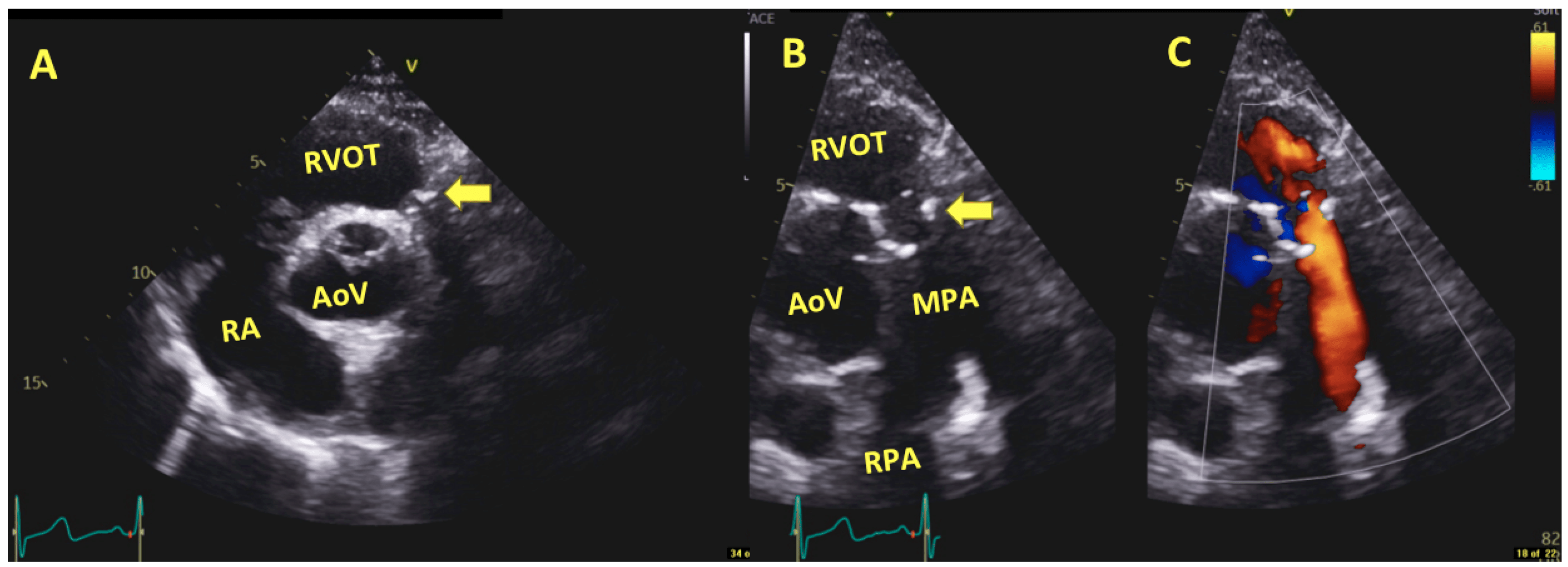 Jcm 13 00630 g001 Jcm 13 00630 g001