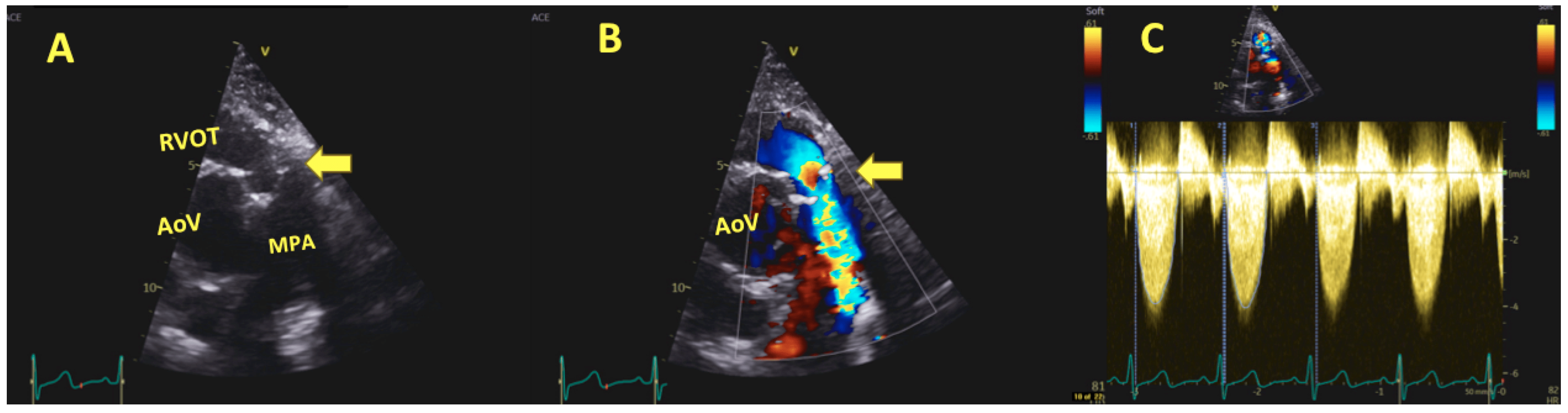 Jcm 13 00630 g002 Jcm 13 00630 g002