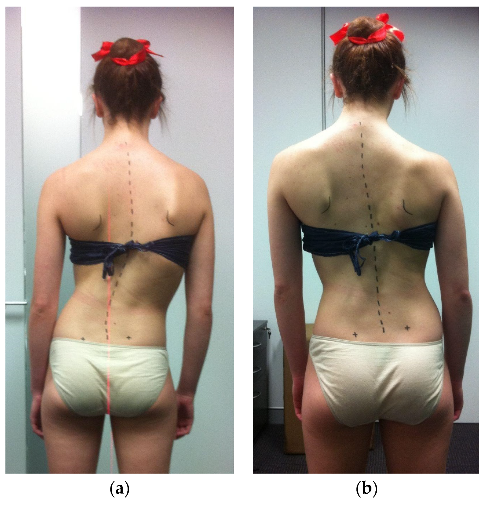 Jcm 13 00653 g0a2 Jcm 13 00653 g0a2