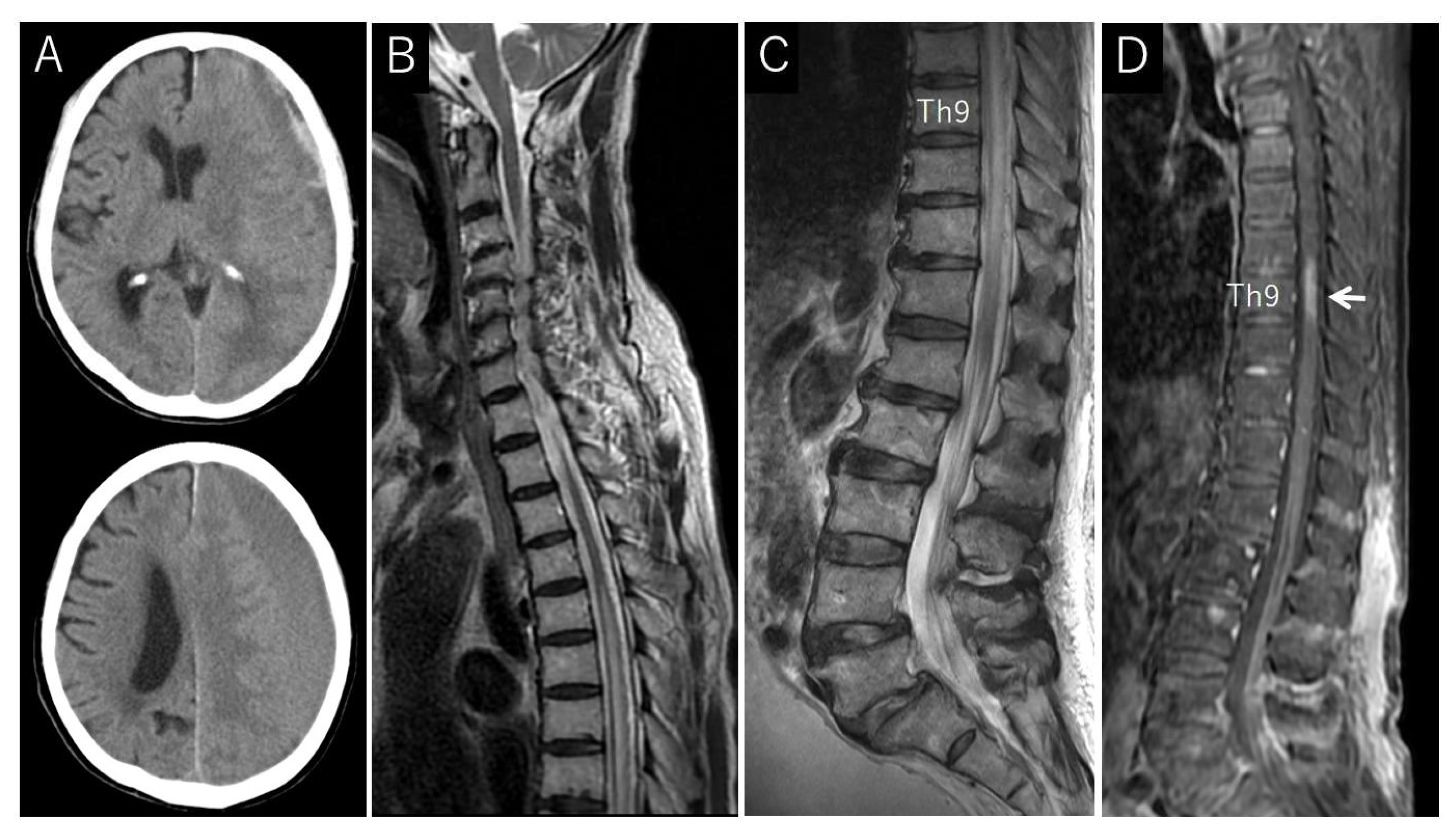 Jcm 13 00711 g002 Jcm 13 00711 g002