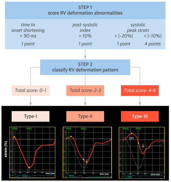 RV vs VCF Stats： See Who Is Expected To Score!