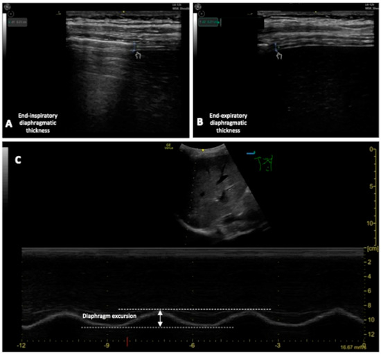 Jcm 13 00750 g006