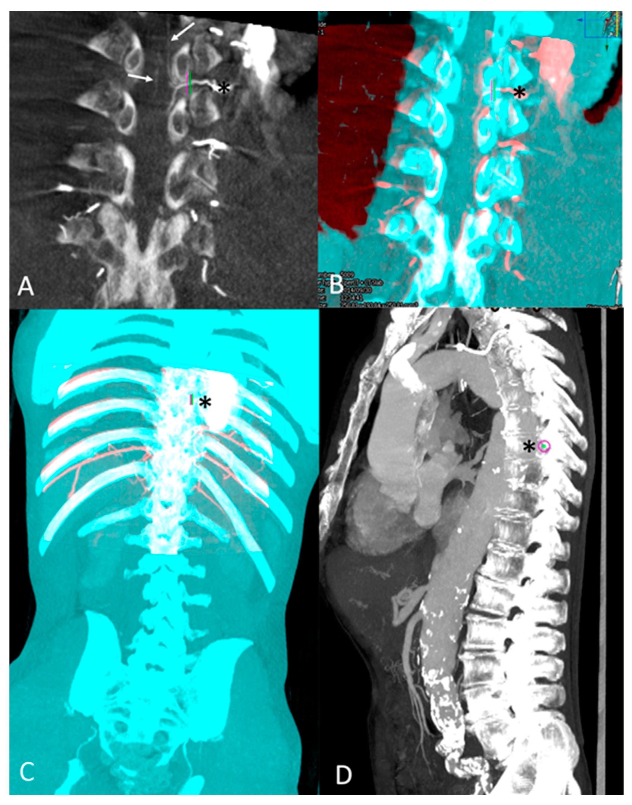 Jcm 13 00796 g002 Jcm 13 00796 g002
